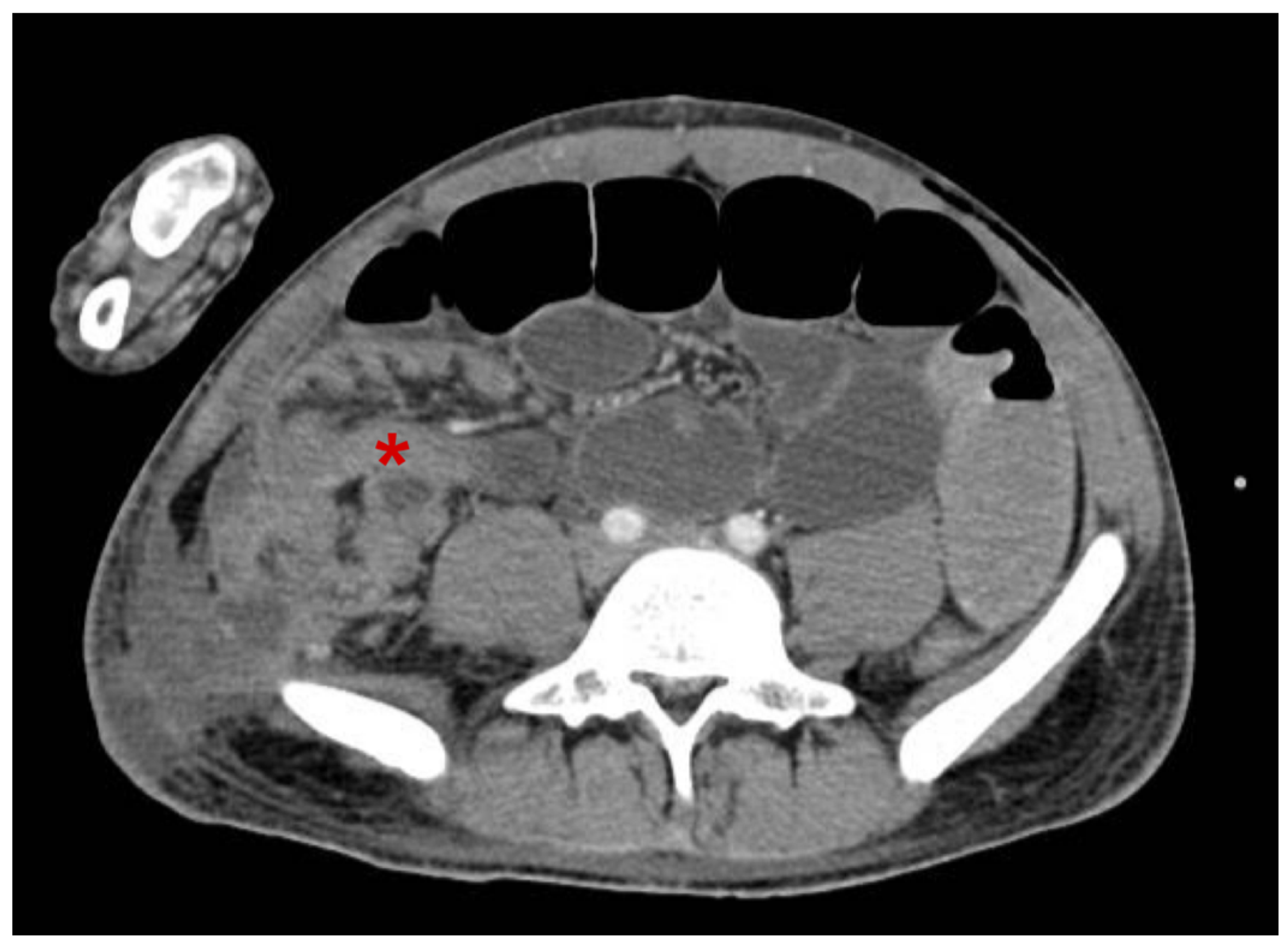 Complications 01 00006 g001