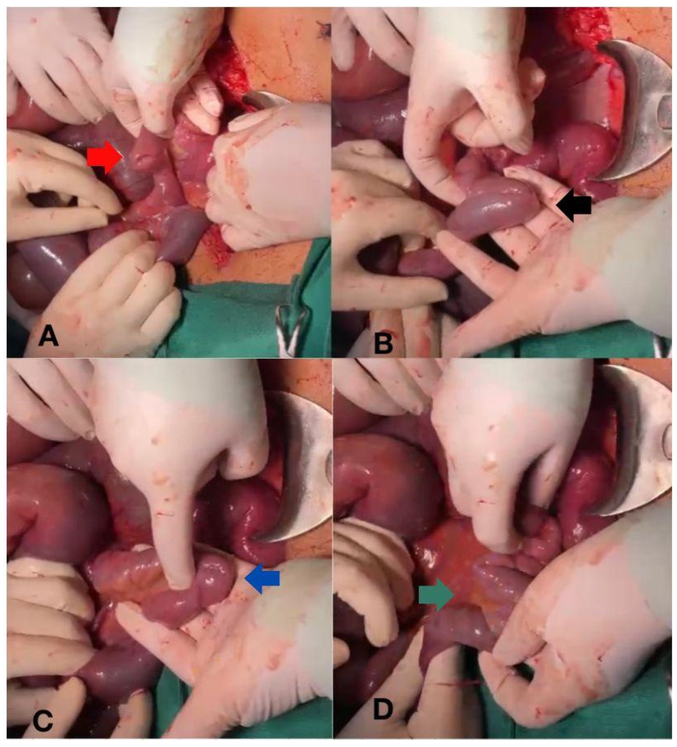 Complications 01 00006 g002