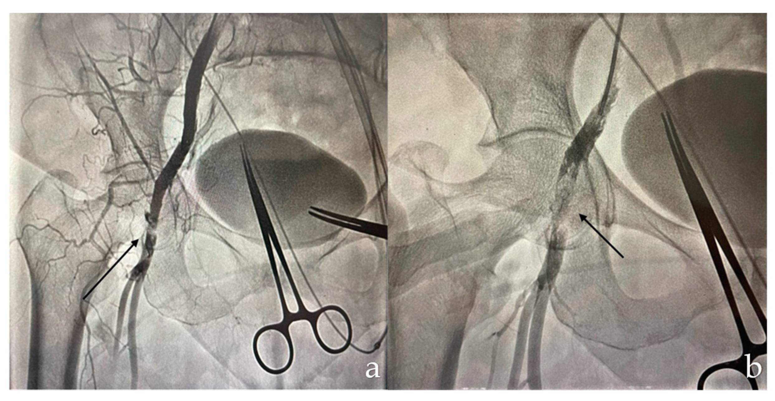 Complications 01 00007 g001 Complications 01 00007 g001