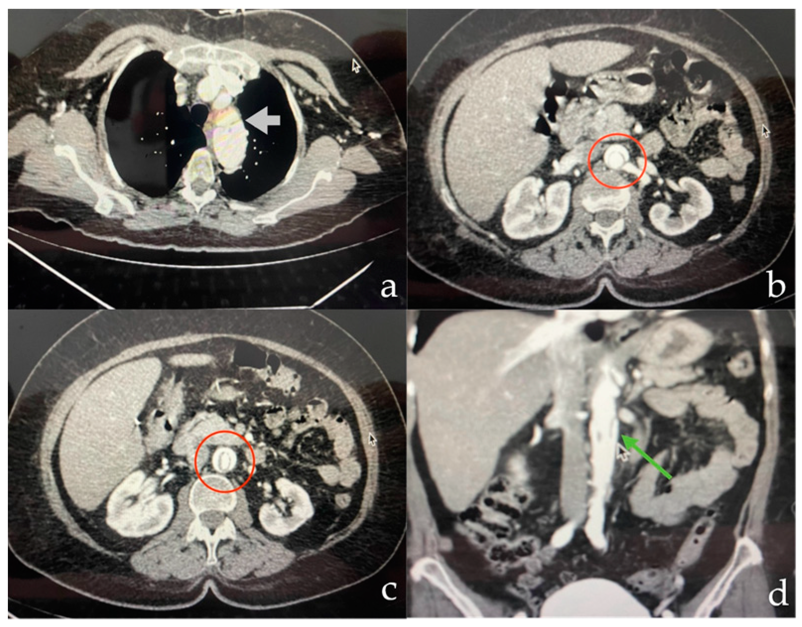 Complications 01 00007 g002 Complications 01 00007 g002
