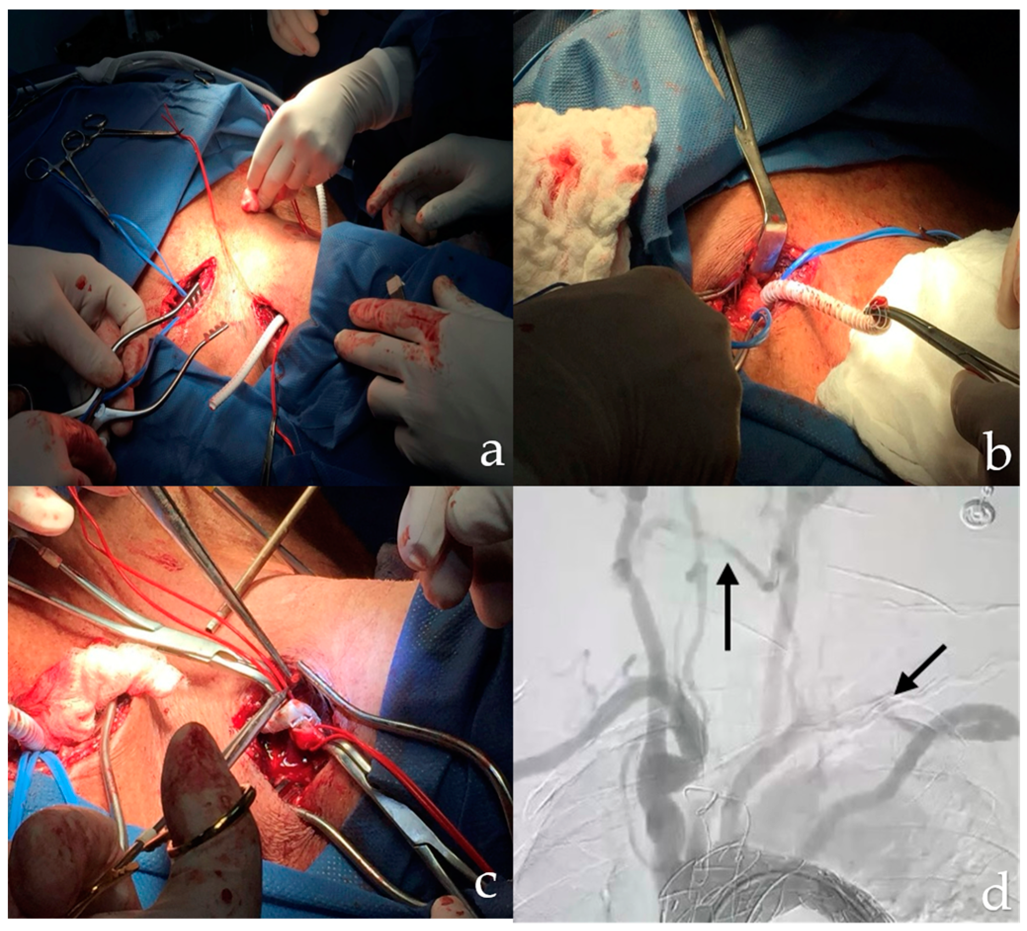 Complications 01 00007 g003 Complications 01 00007 g003