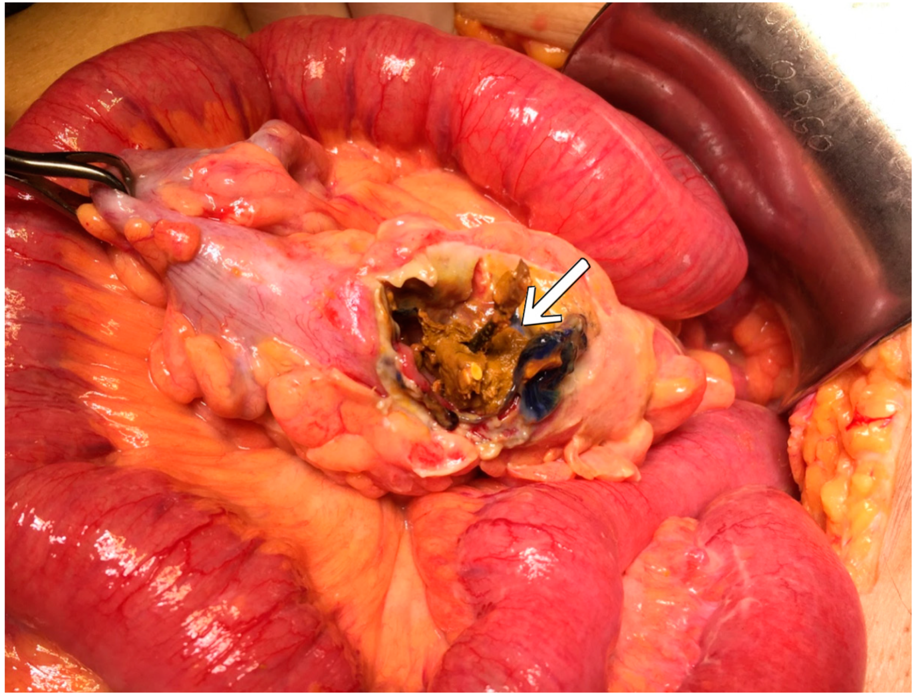 Complications 01 00008 g001 Complications 01 00008 g001