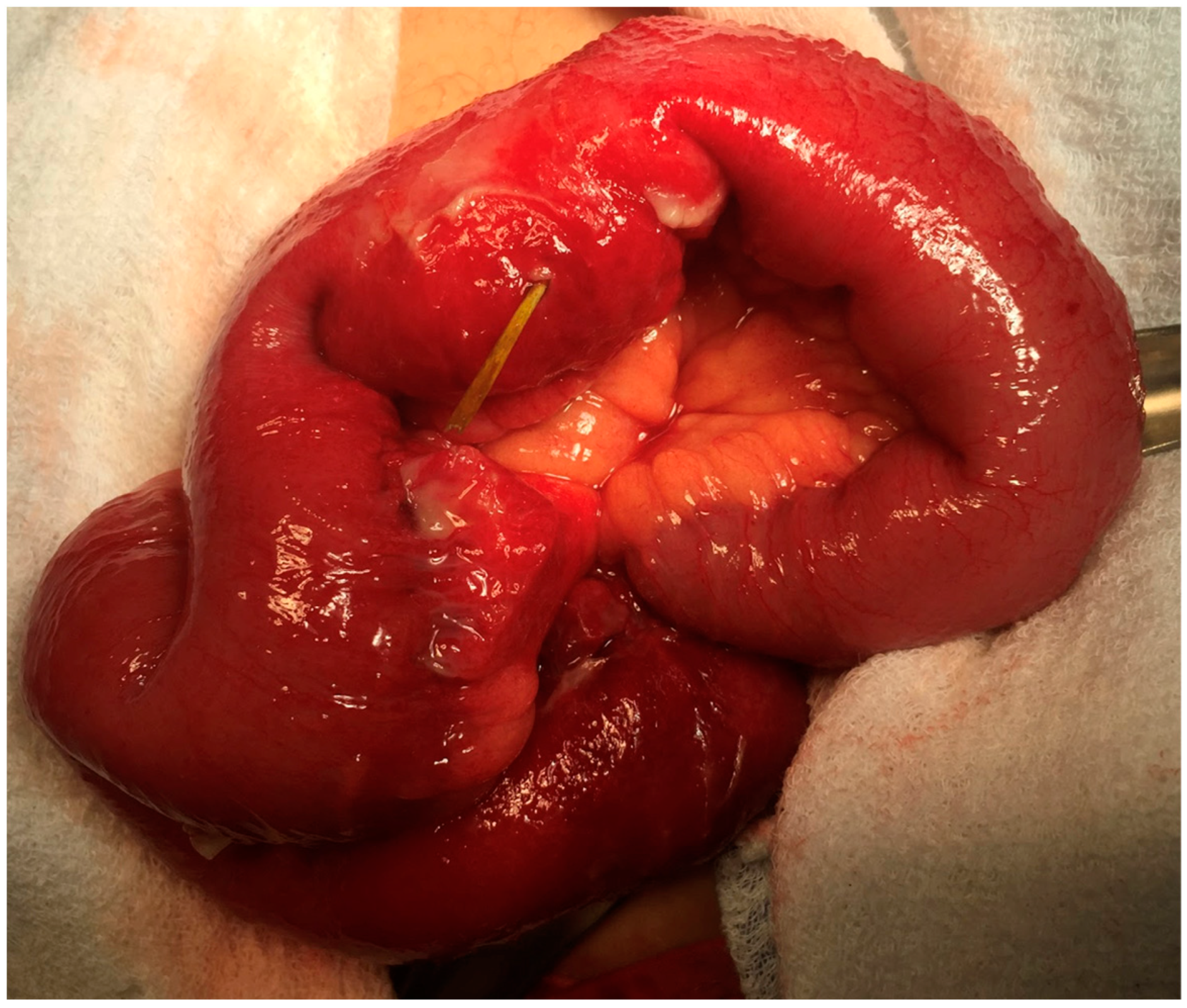 Complications 01 00008 g002 Complications 01 00008 g002