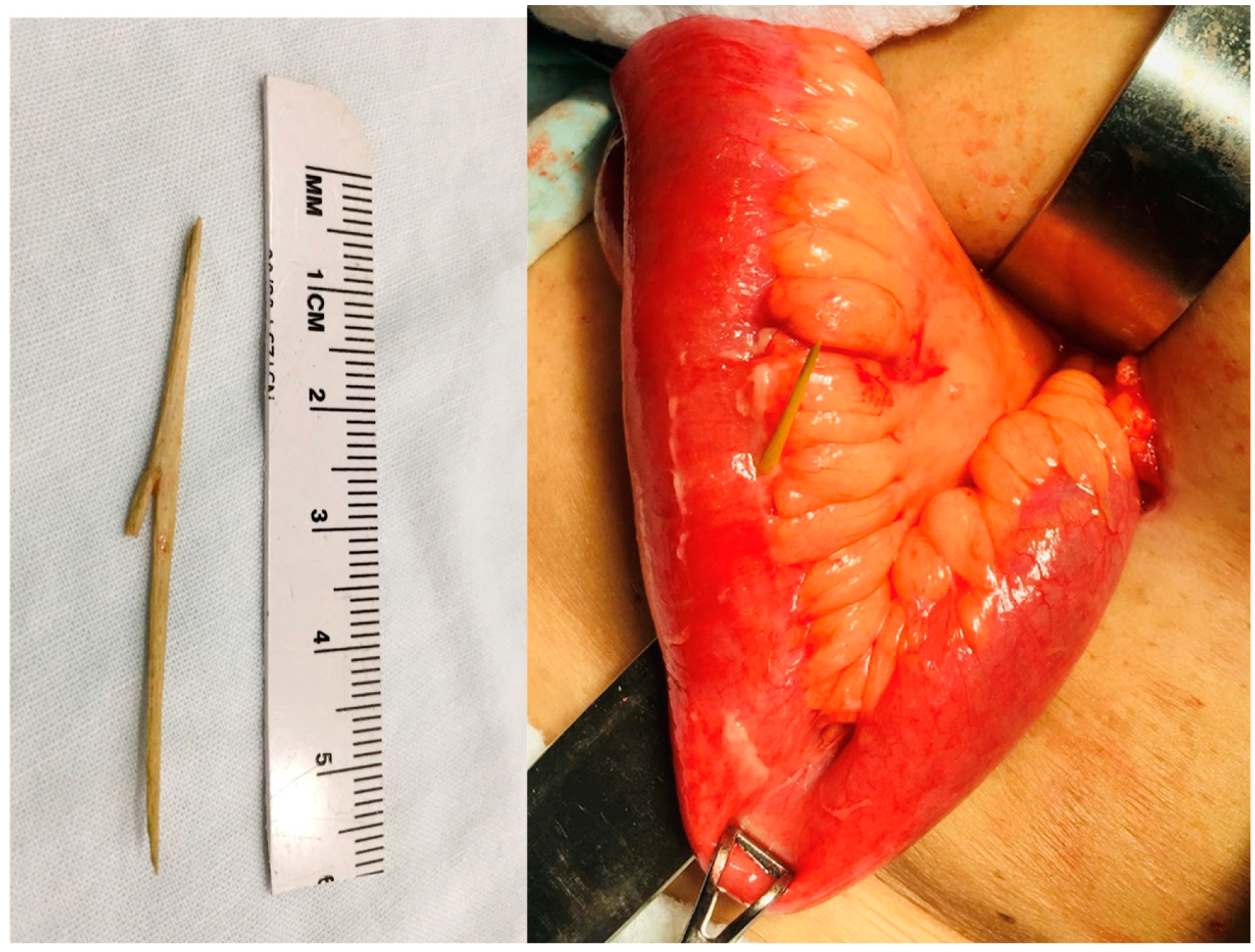 Complications 01 00008 g003 Complications 01 00008 g003