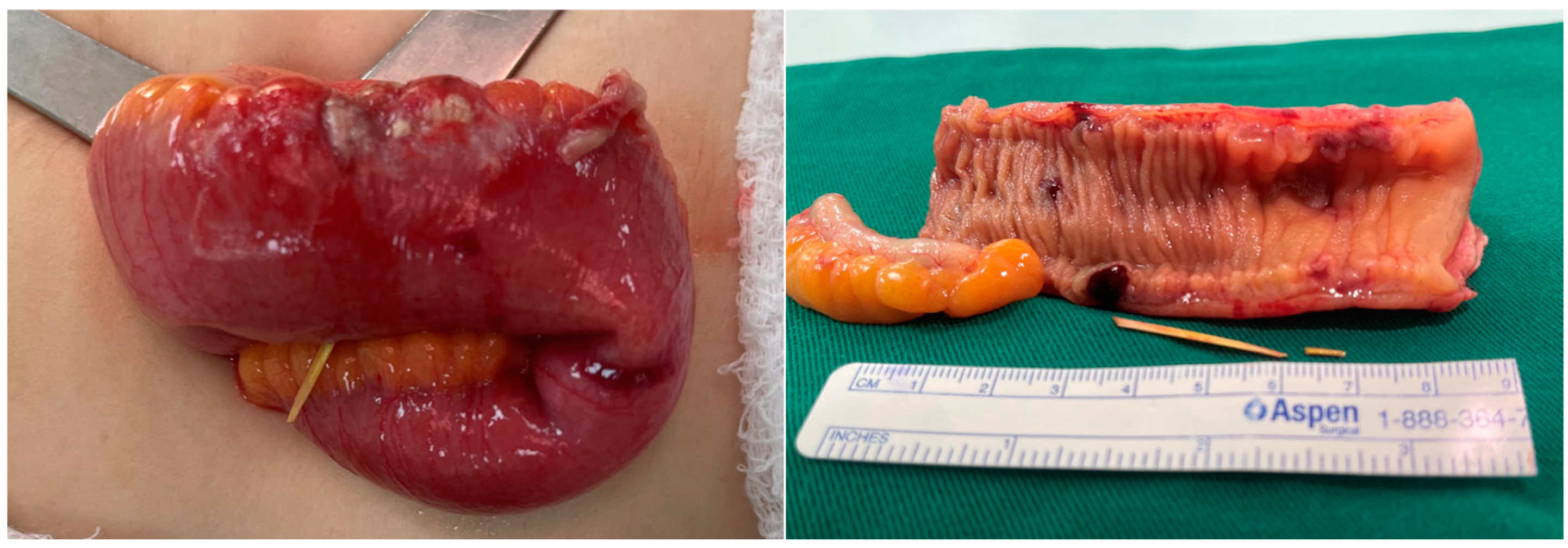 Complications 01 00008 g004 Complications 01 00008 g004