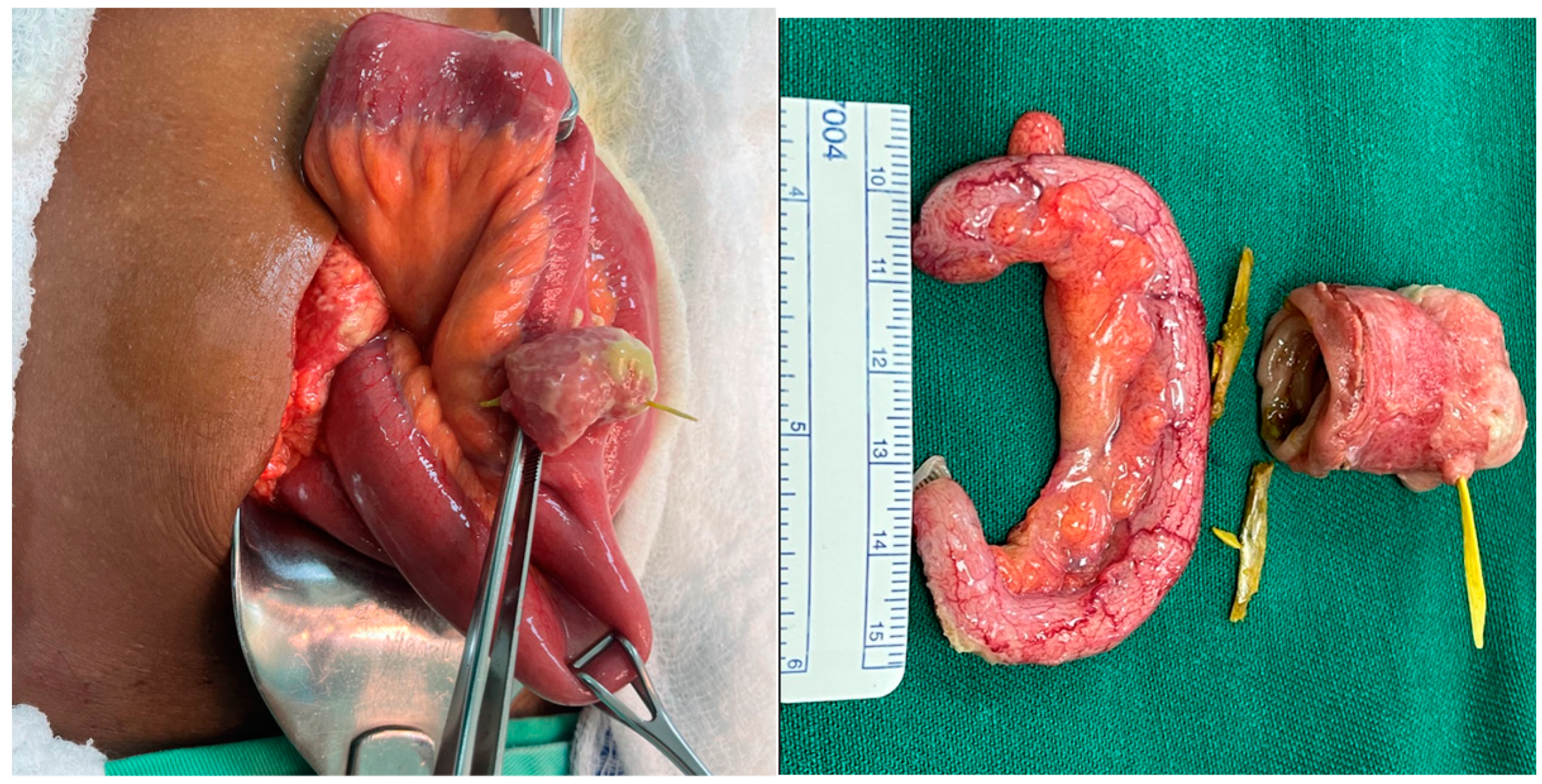 Complications 01 00008 g005 Complications 01 00008 g005