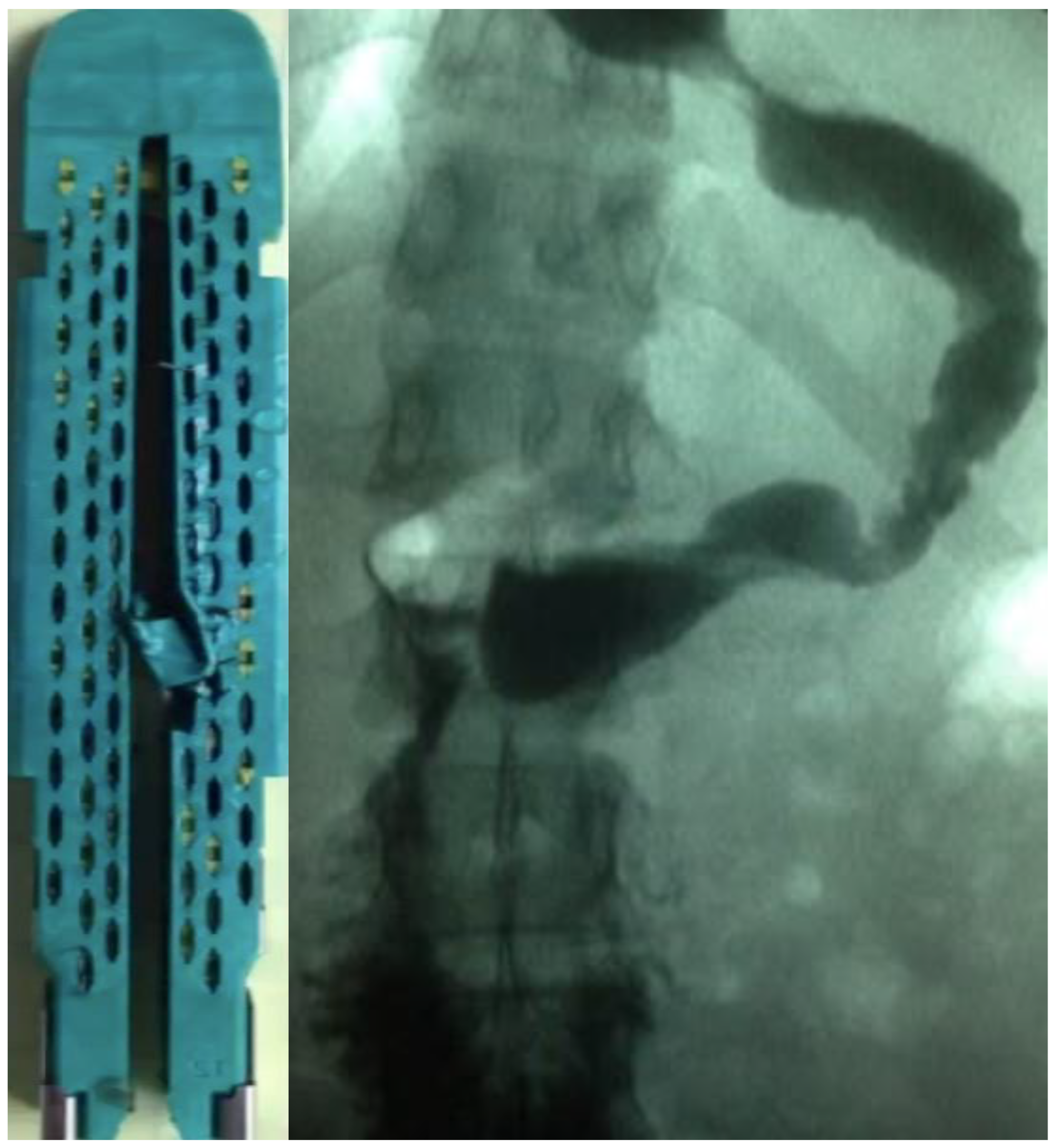 Complications 01 00010 g001