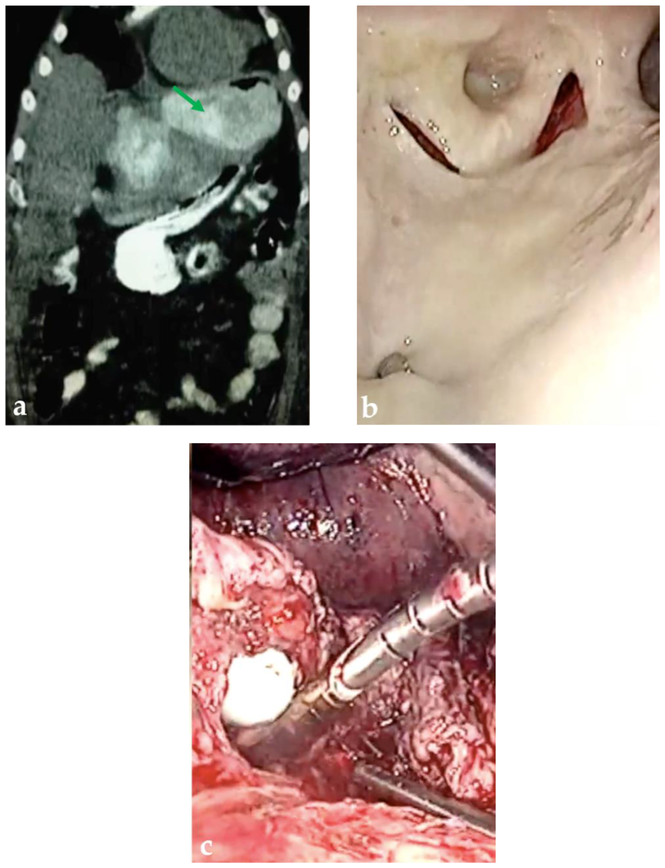 Complications 01 00010 g002