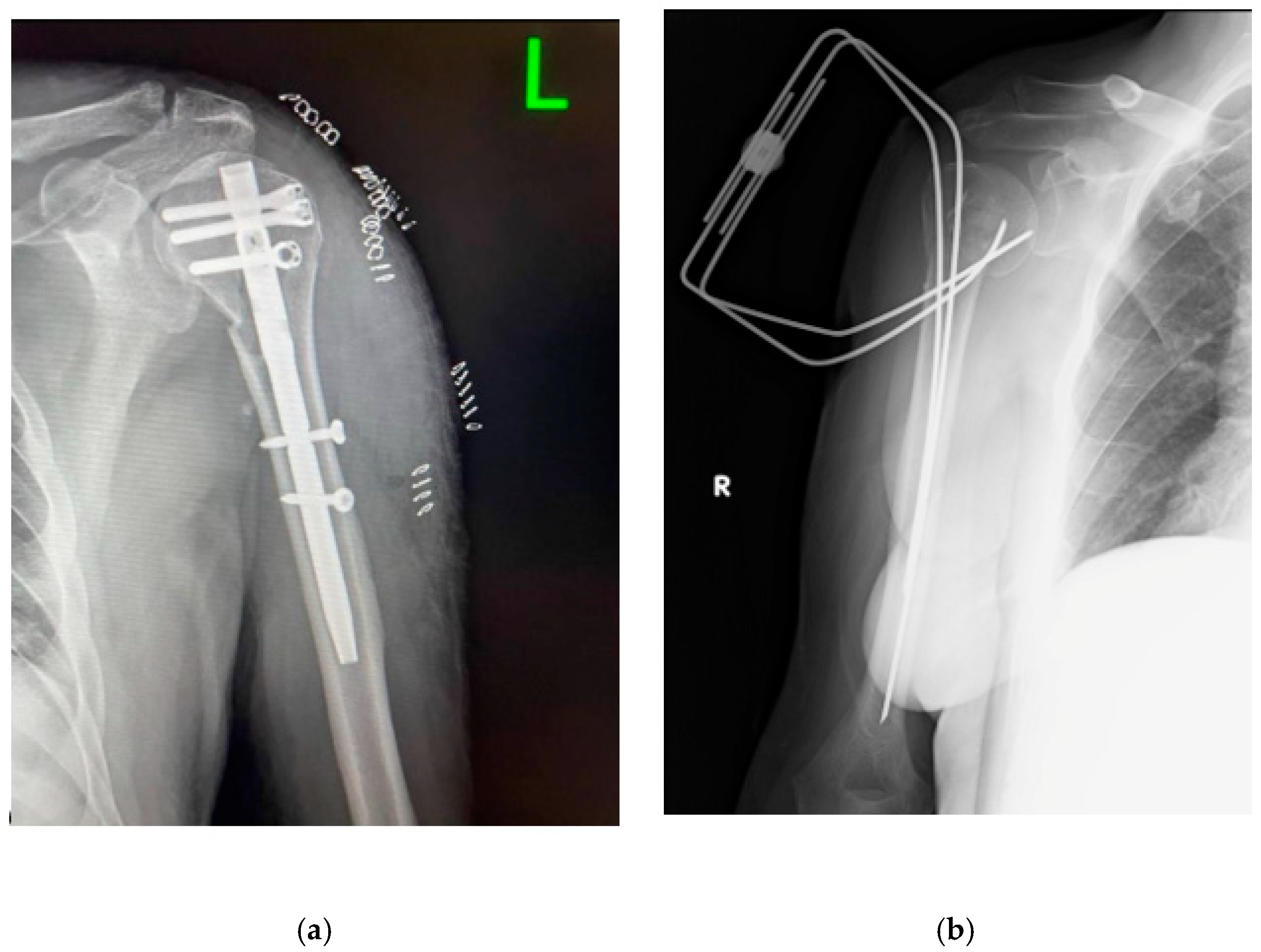 Complications 01 00013 g001