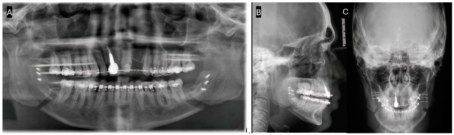 Complications 02 00003 g001