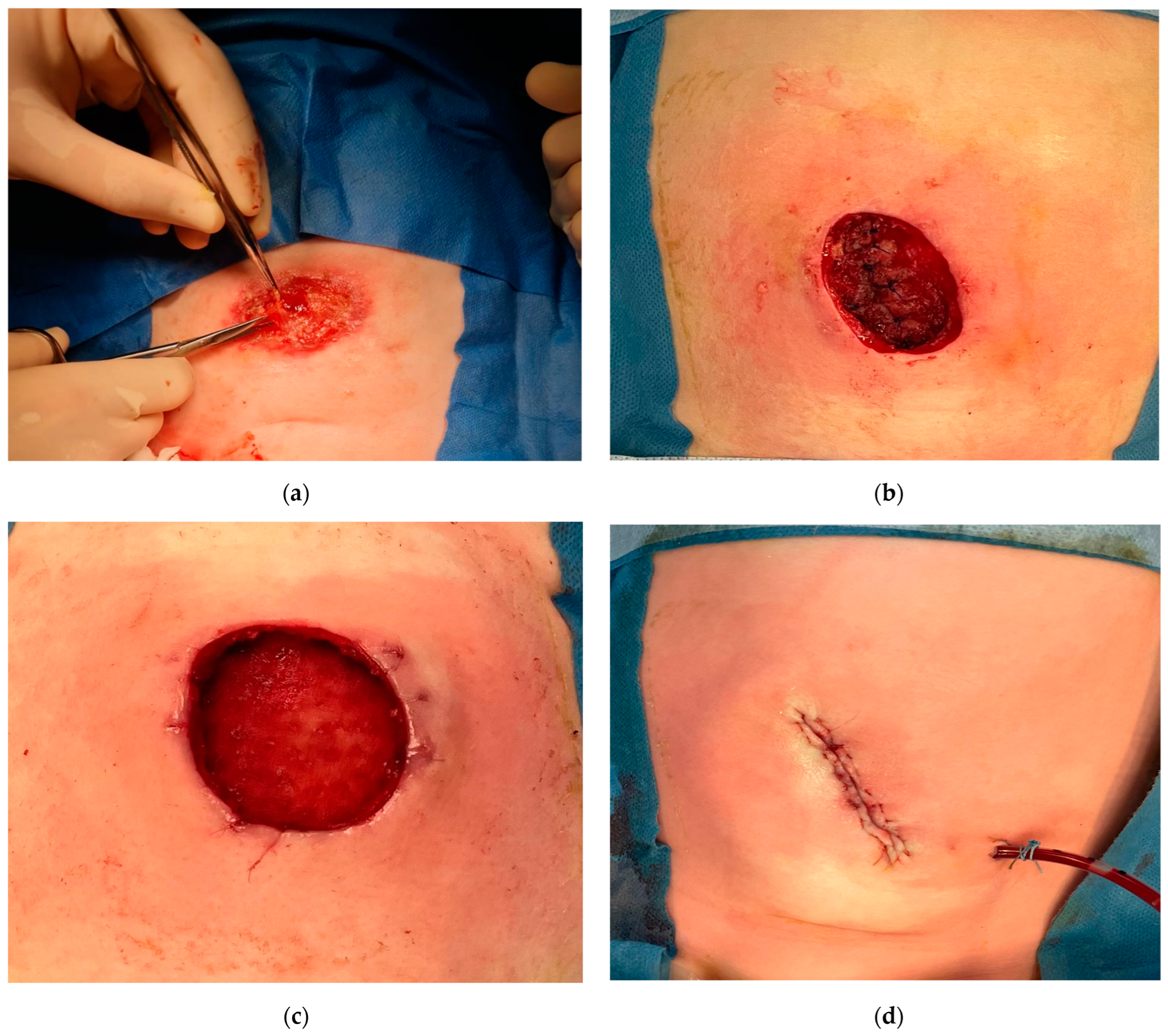 Complications 02 00004 g001