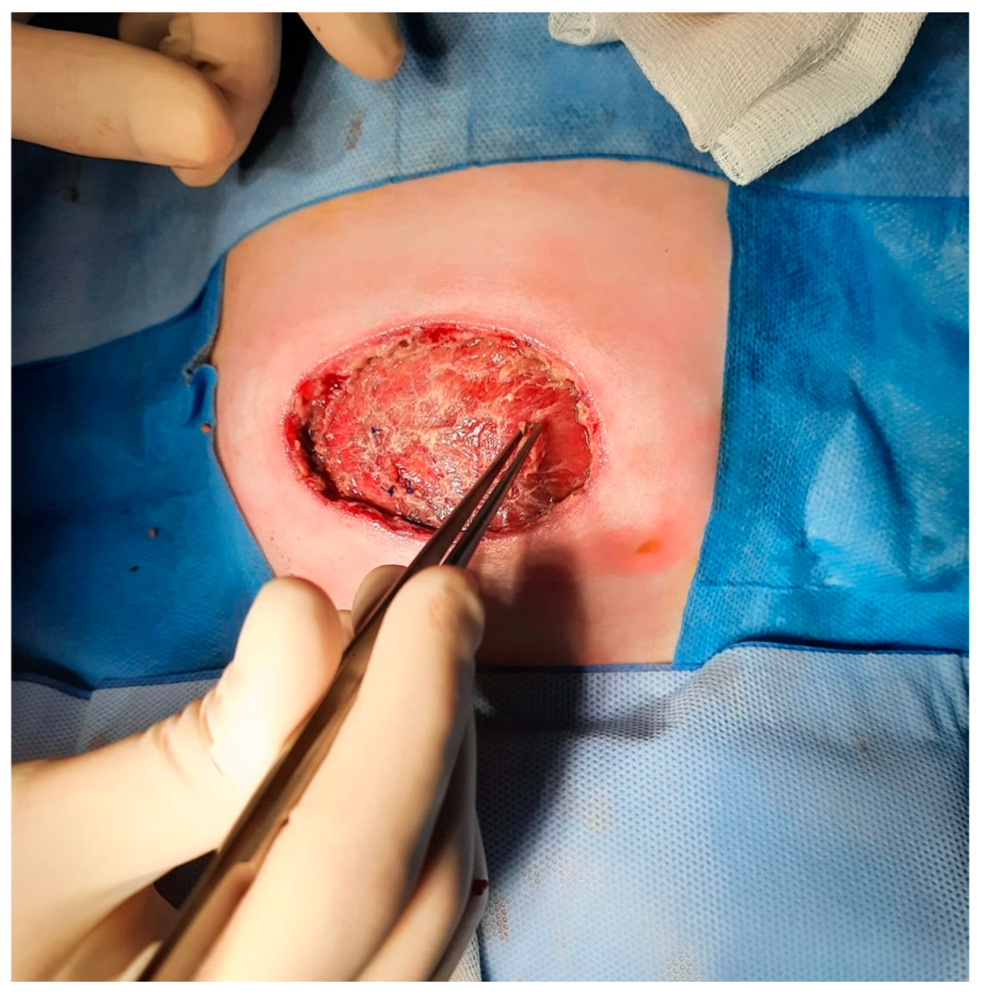 Complications 02 00004 g004