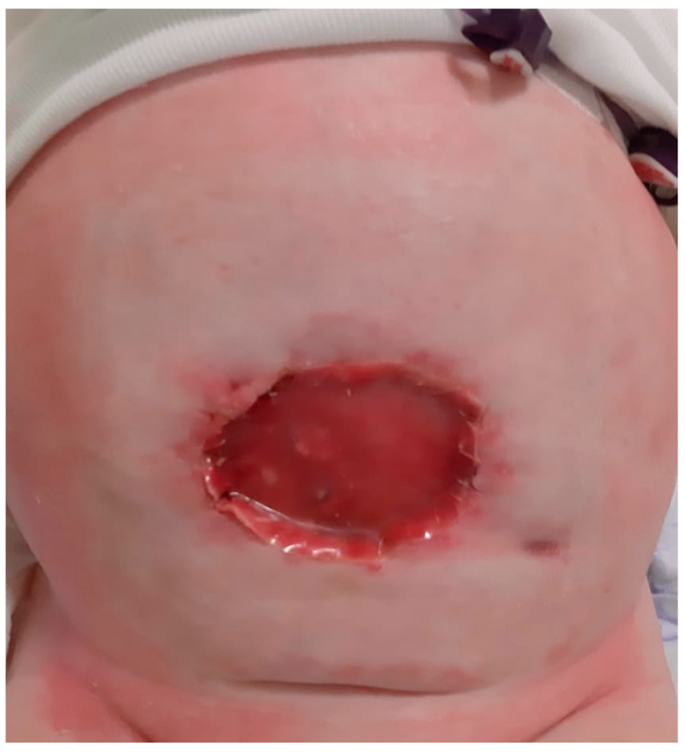 Complications 02 00004 g005