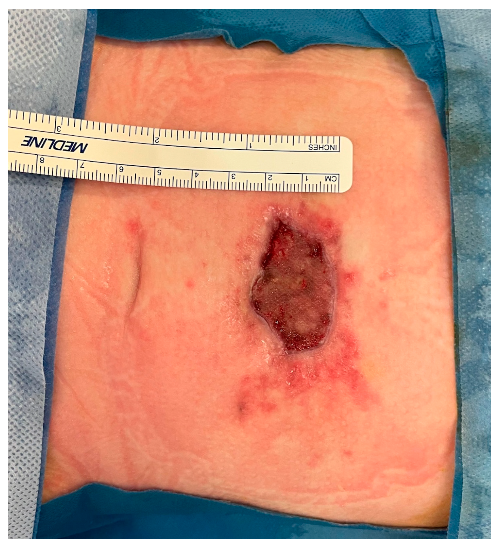 Complications 02 00004 g006