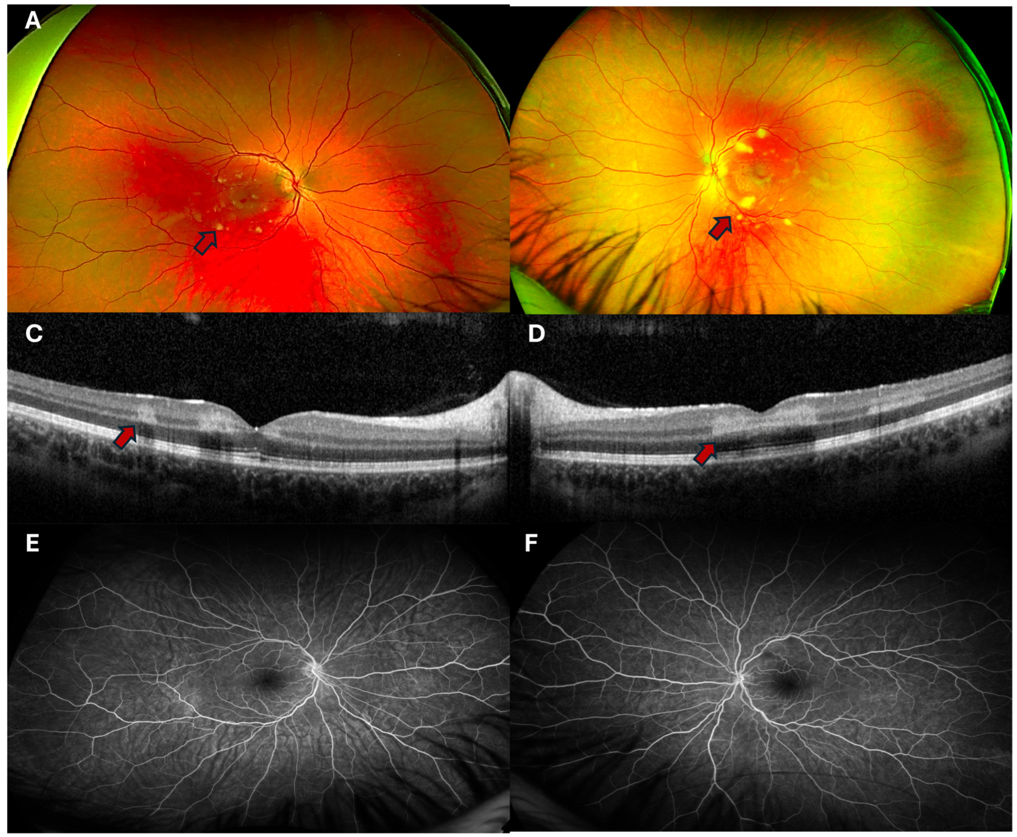 Complications 02 00006 g001