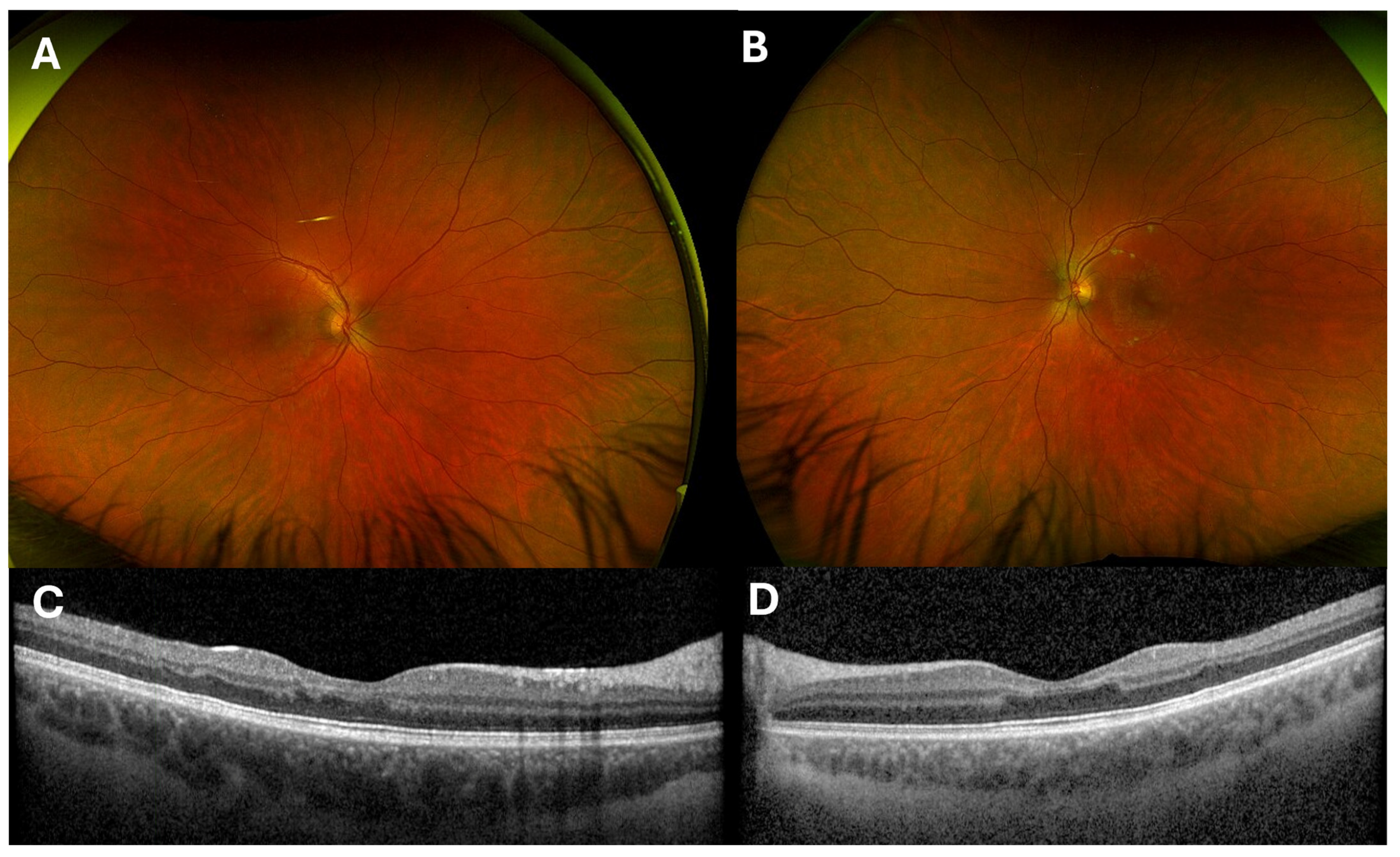 Complications 02 00006 g004