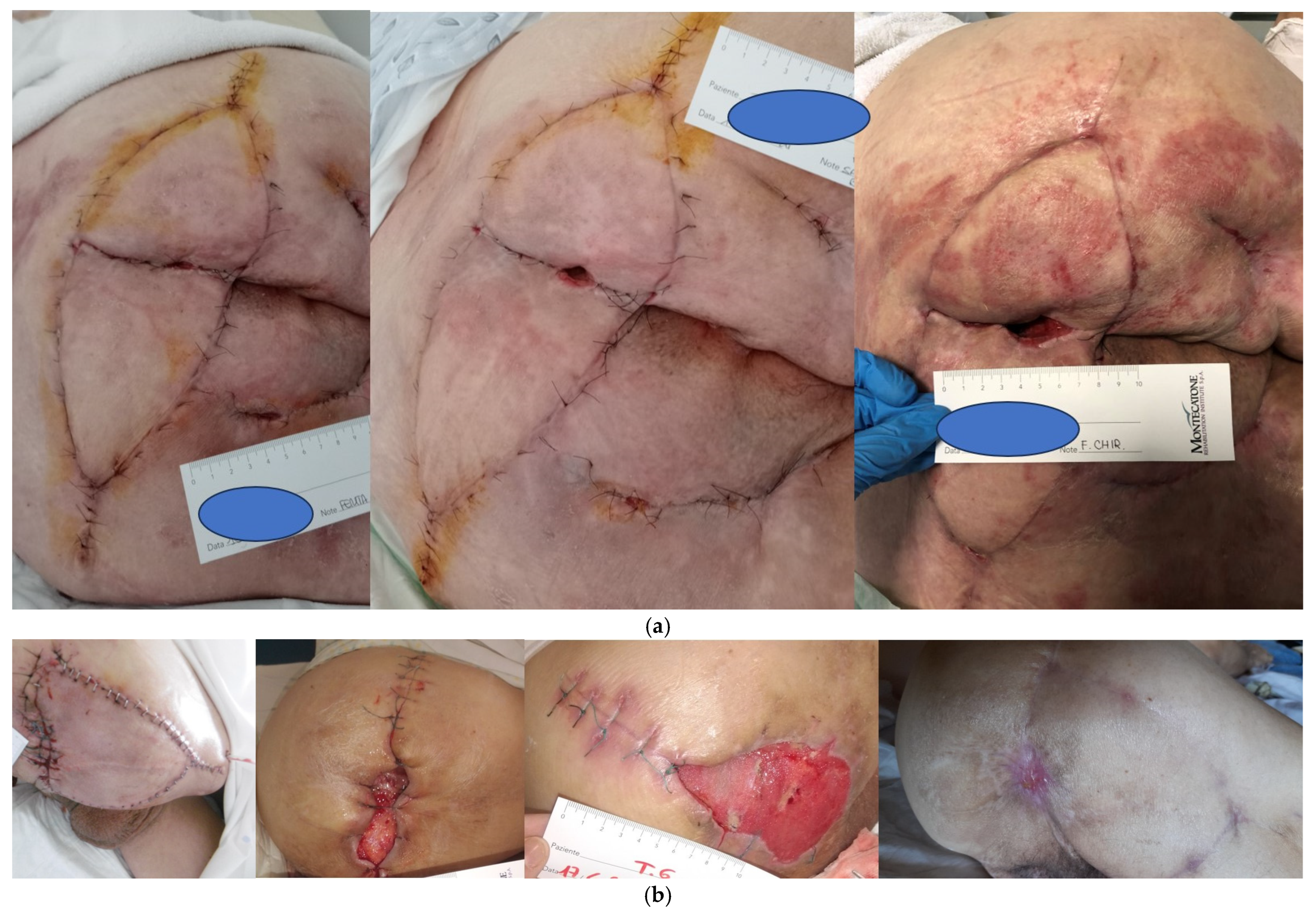 Complications 02 00015 g001