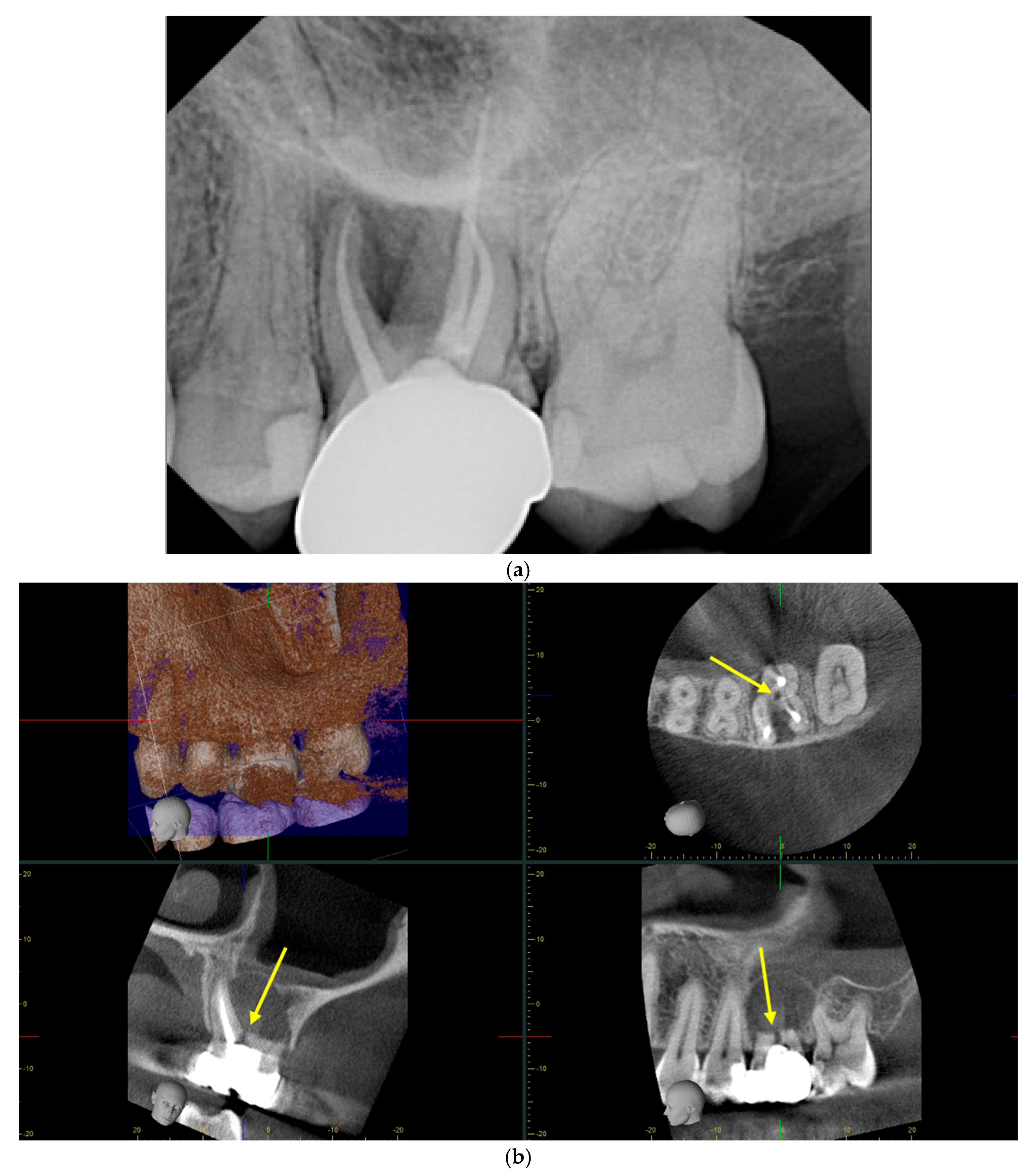 Complications 02 00017 g002
