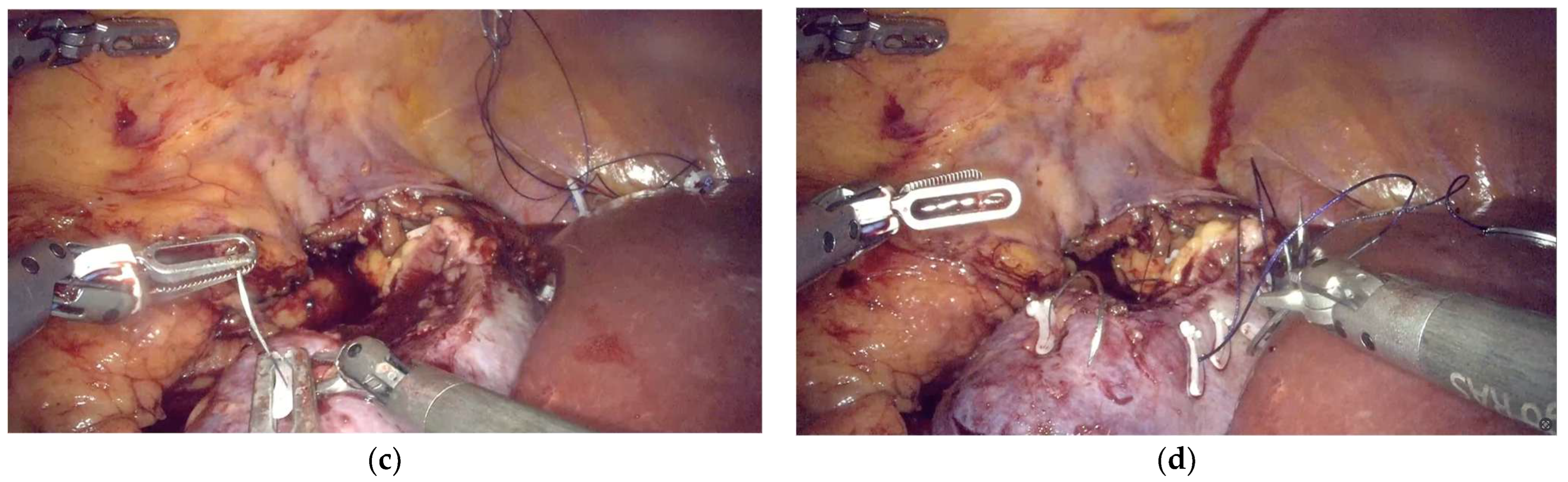 Complications 02 00021 g001b