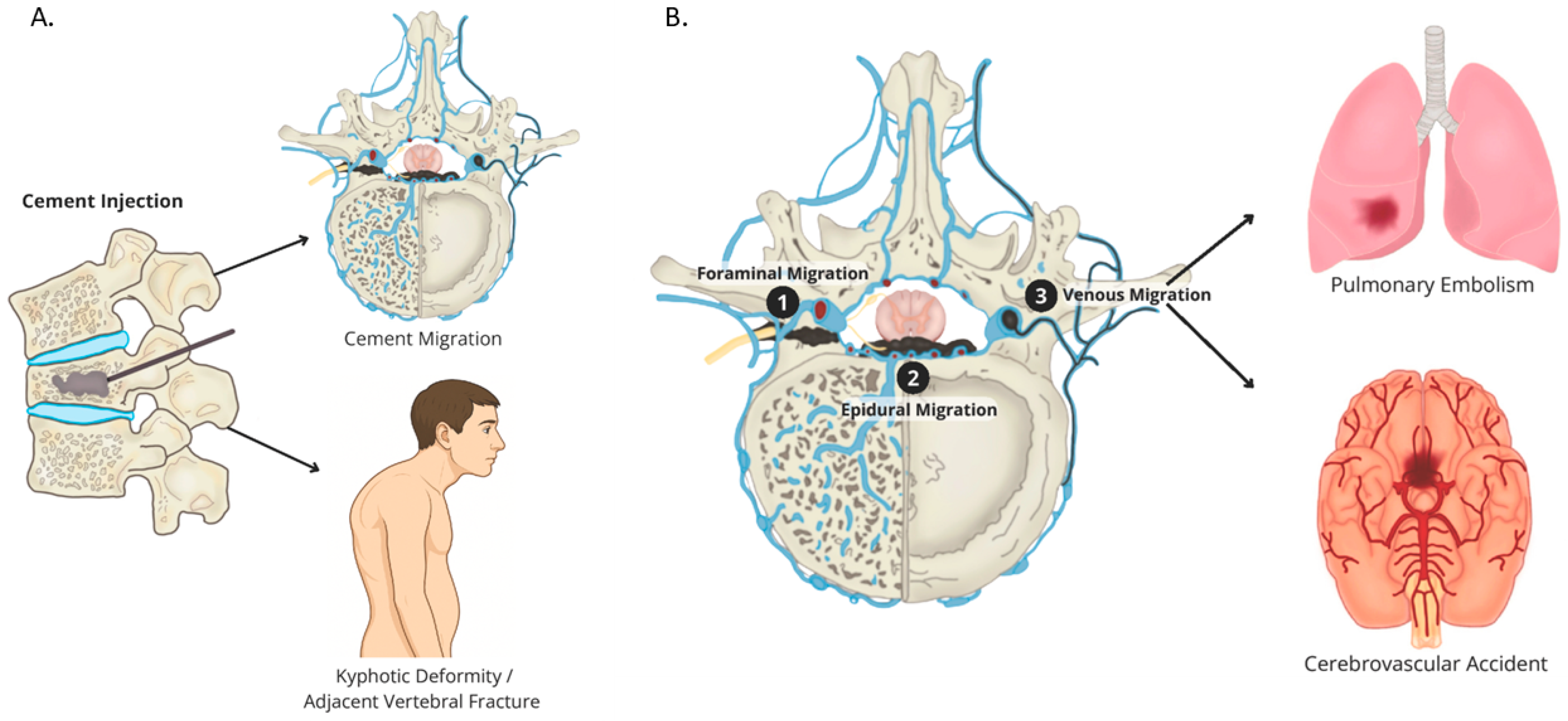 Complications 02 00022 g002
