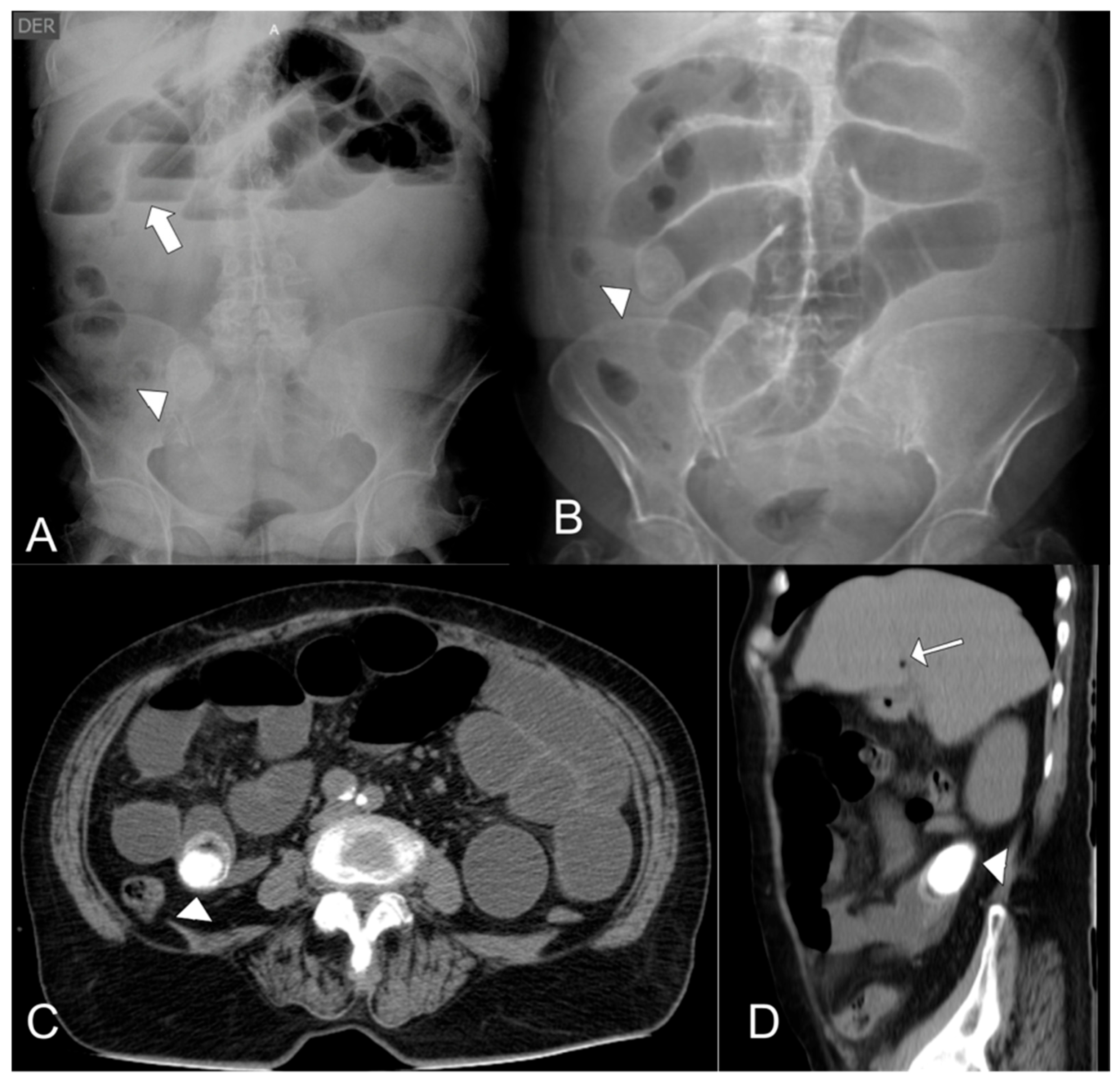 Complications 03 00002 g001 Complications 03 00002 g001