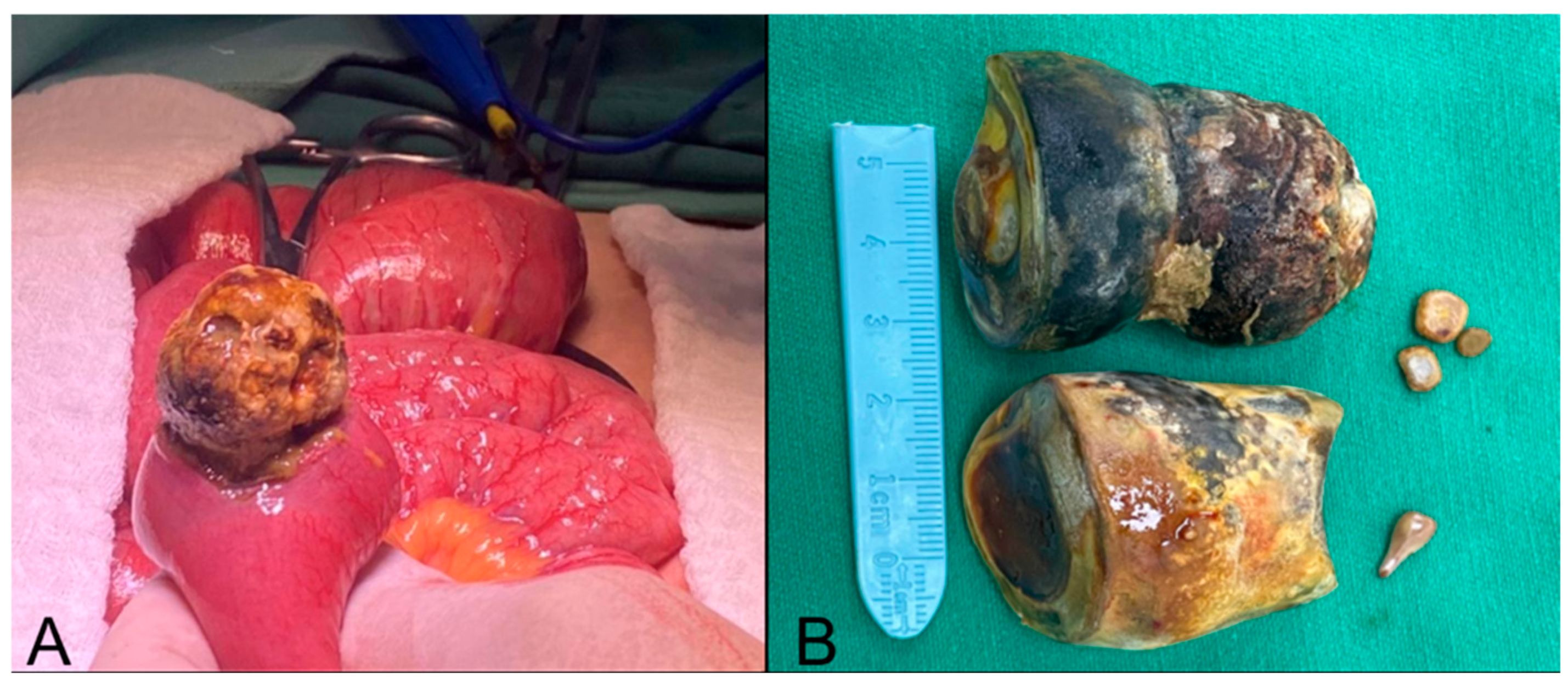 Complications 03 00002 g003 Complications 03 00002 g003