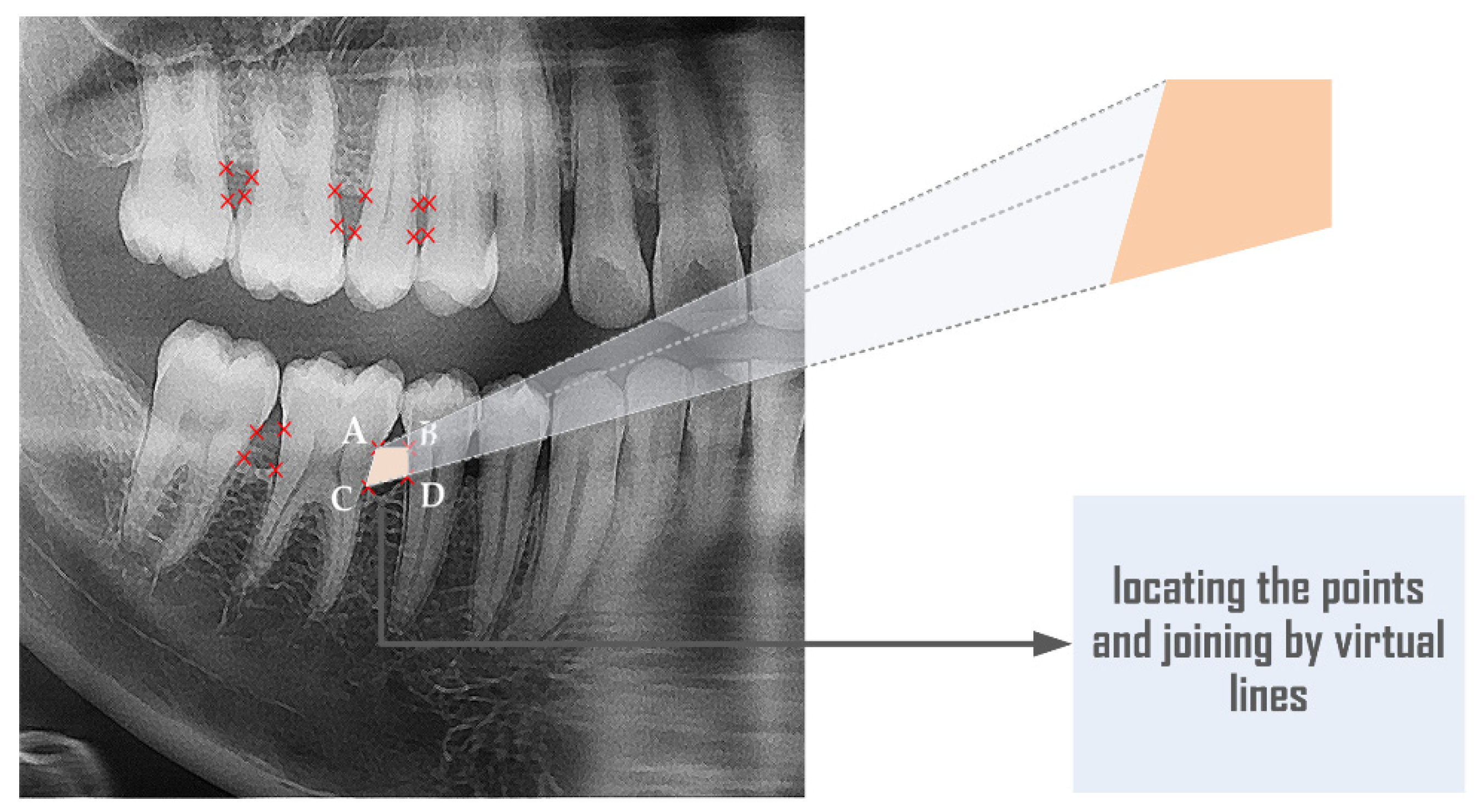 Computation 10 00008 g003