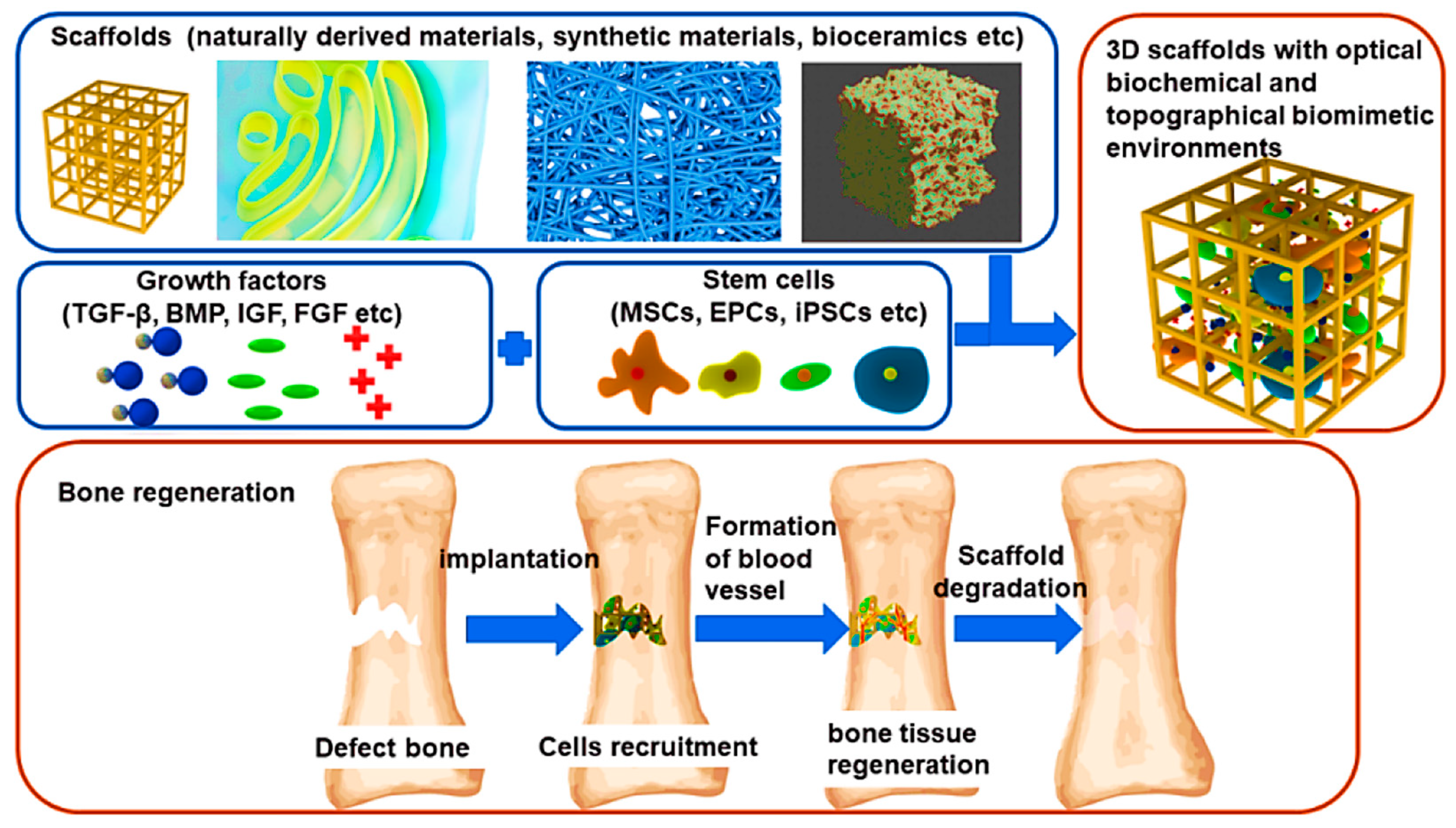 Computational Modelling and Simulation of Scaffolds for Bone 