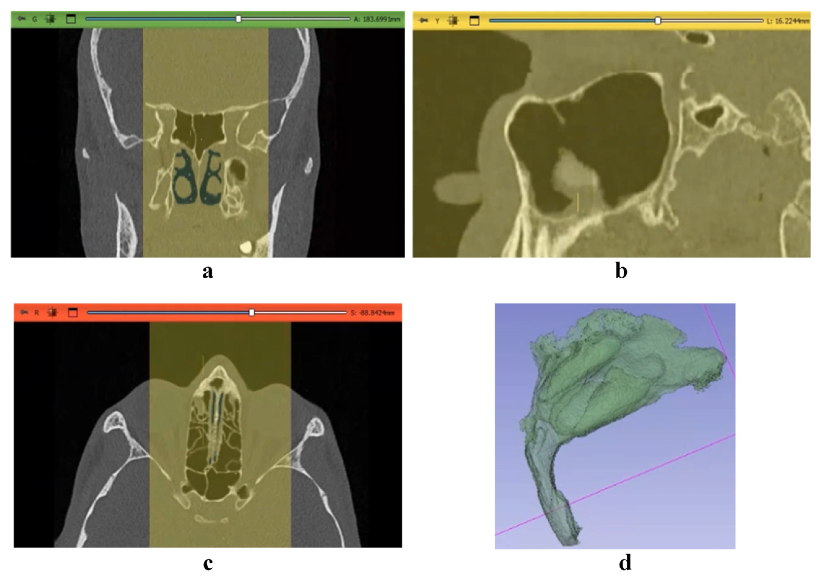 Computation 12 00134 g003