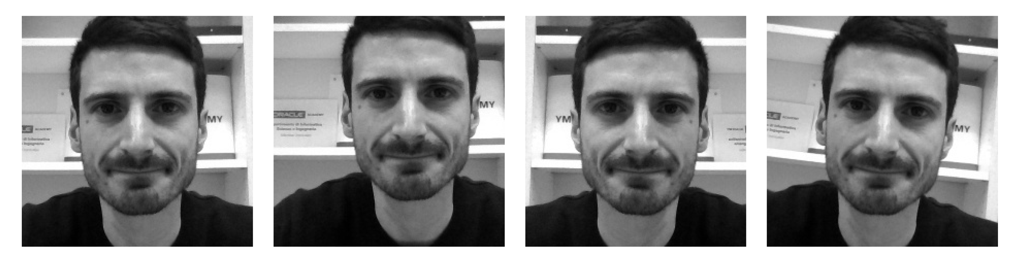 cataplexy face cataplexy face