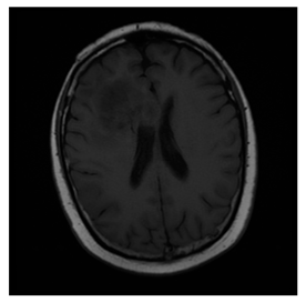 Computers 10 00152 i011