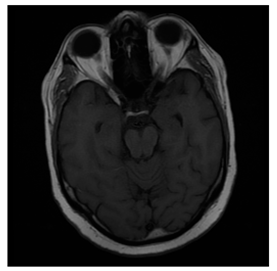 Computers 10 00152 i013