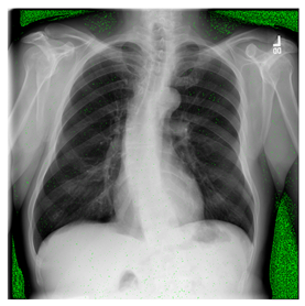 Computers 10 00152 i021