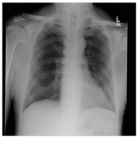 Computers 10 00152 i026