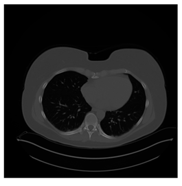 Computers 10 00152 i028