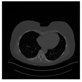 Computers 10 00152 i029