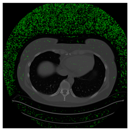 Computers 10 00152 i033