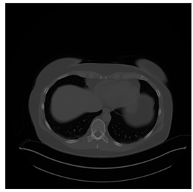 Computers 10 00152 i034