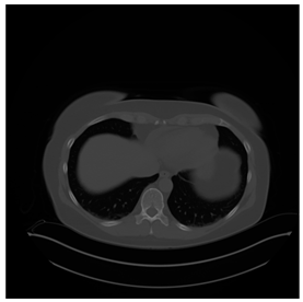 Computers 10 00152 i035