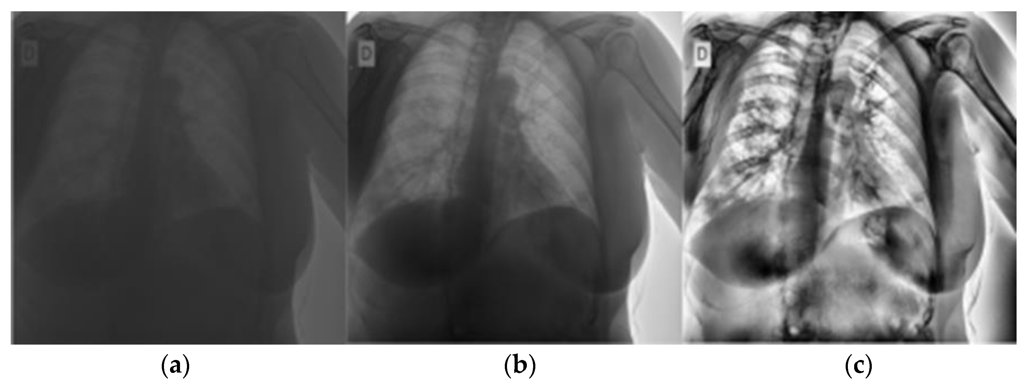 Computers 12 00105 g004 Computers 12 00105 g004