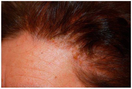 Cosmetics Free Full Text Essential of Hair Care Cosmetics