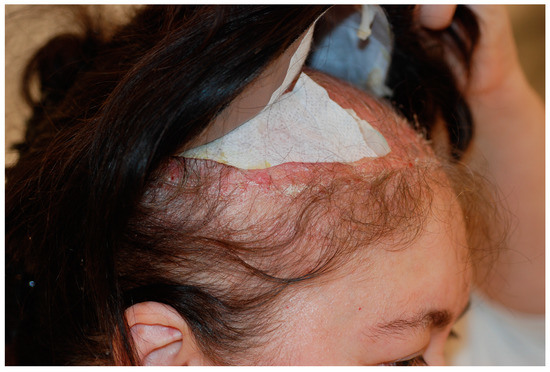 Cosmetics | Free Full-Text | Essential of Hair Care Cosmetics Cosmetics | Free Full-Text | Essential of Hair Care Cosmetics
