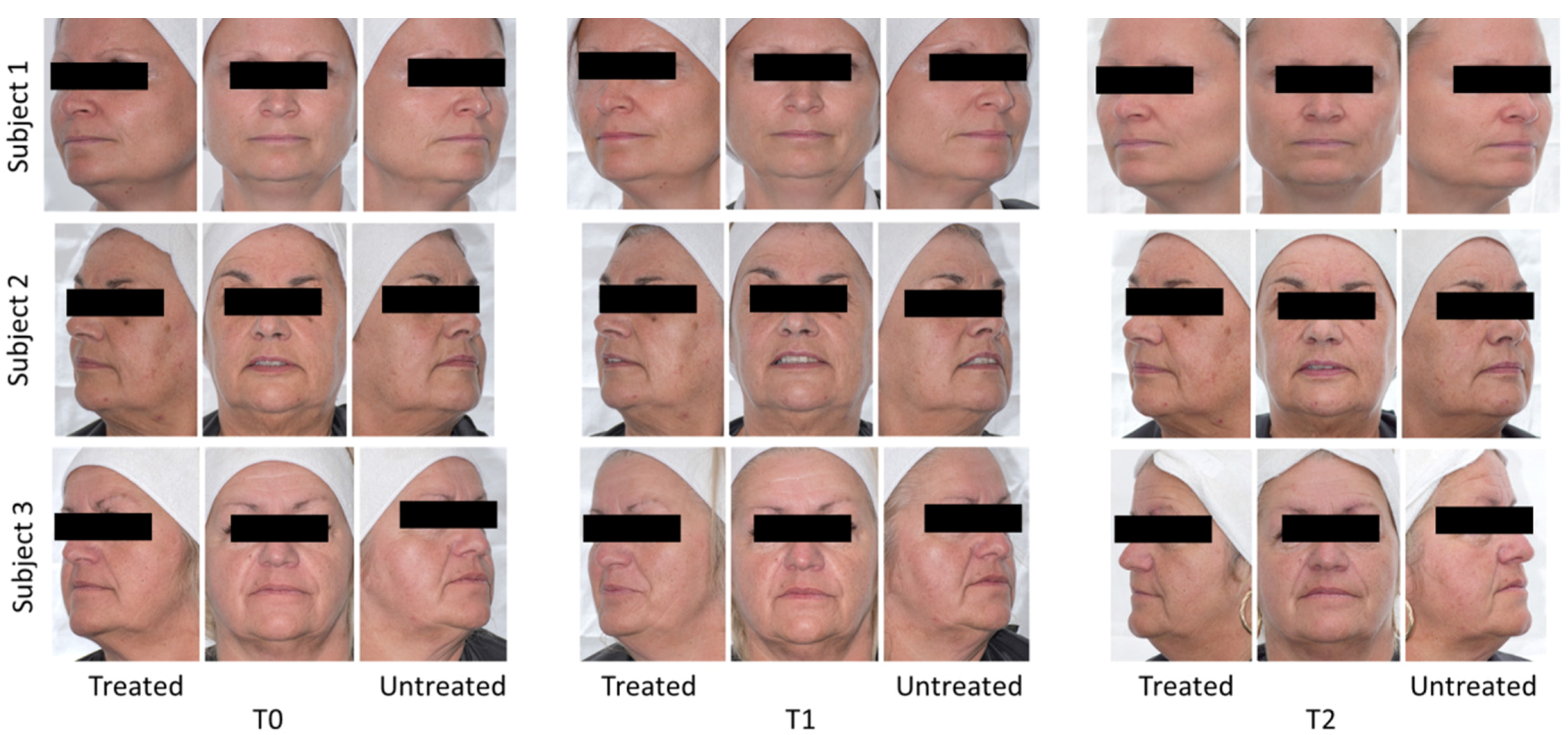 Cosmetics 04 00017 g007 550