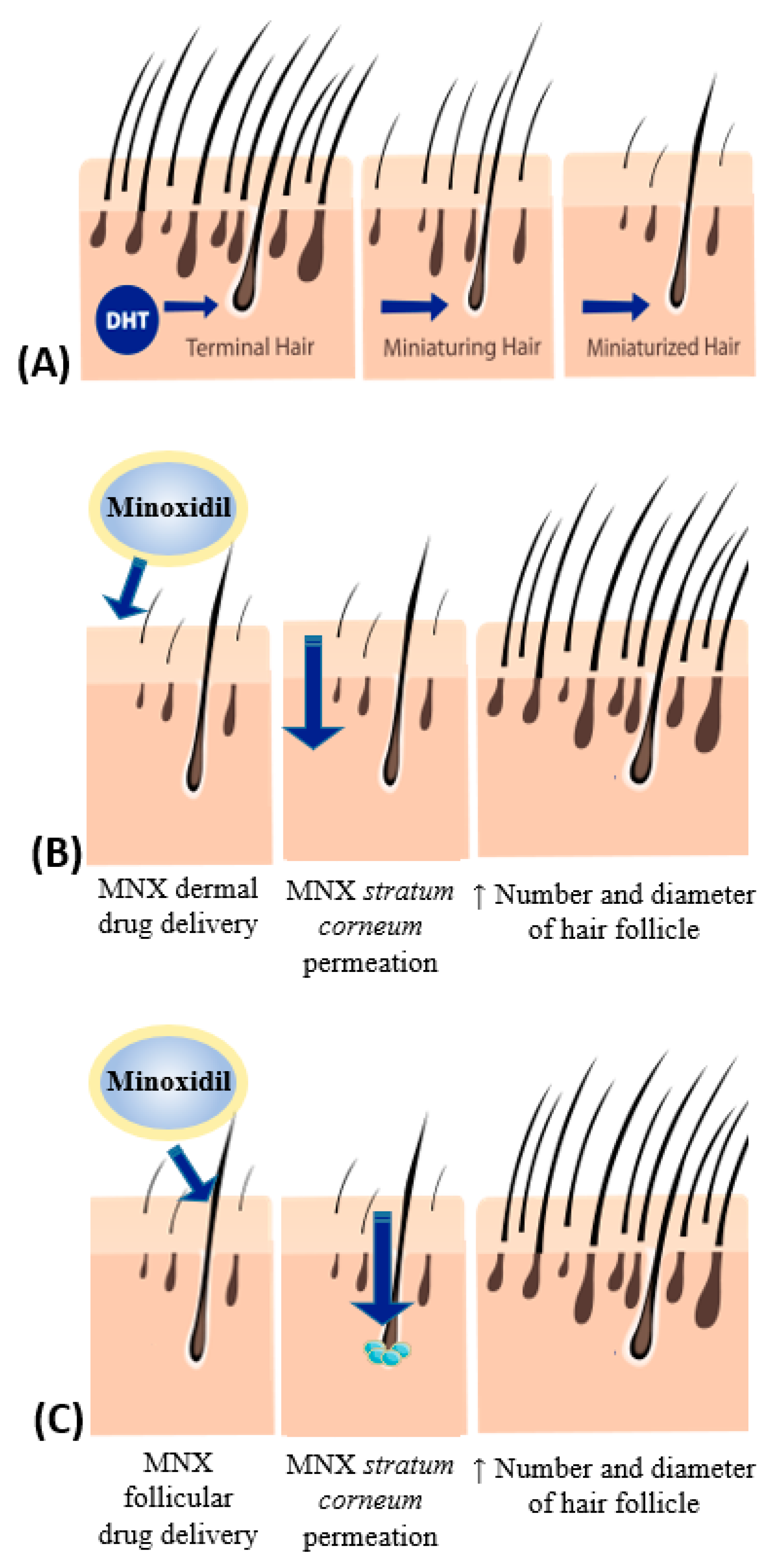 Feasibility sten Penge gummi Cosmetics | Free Full-Text | Topical Minoxidil-Loaded Nanotechnology  Strategies for Alopecia