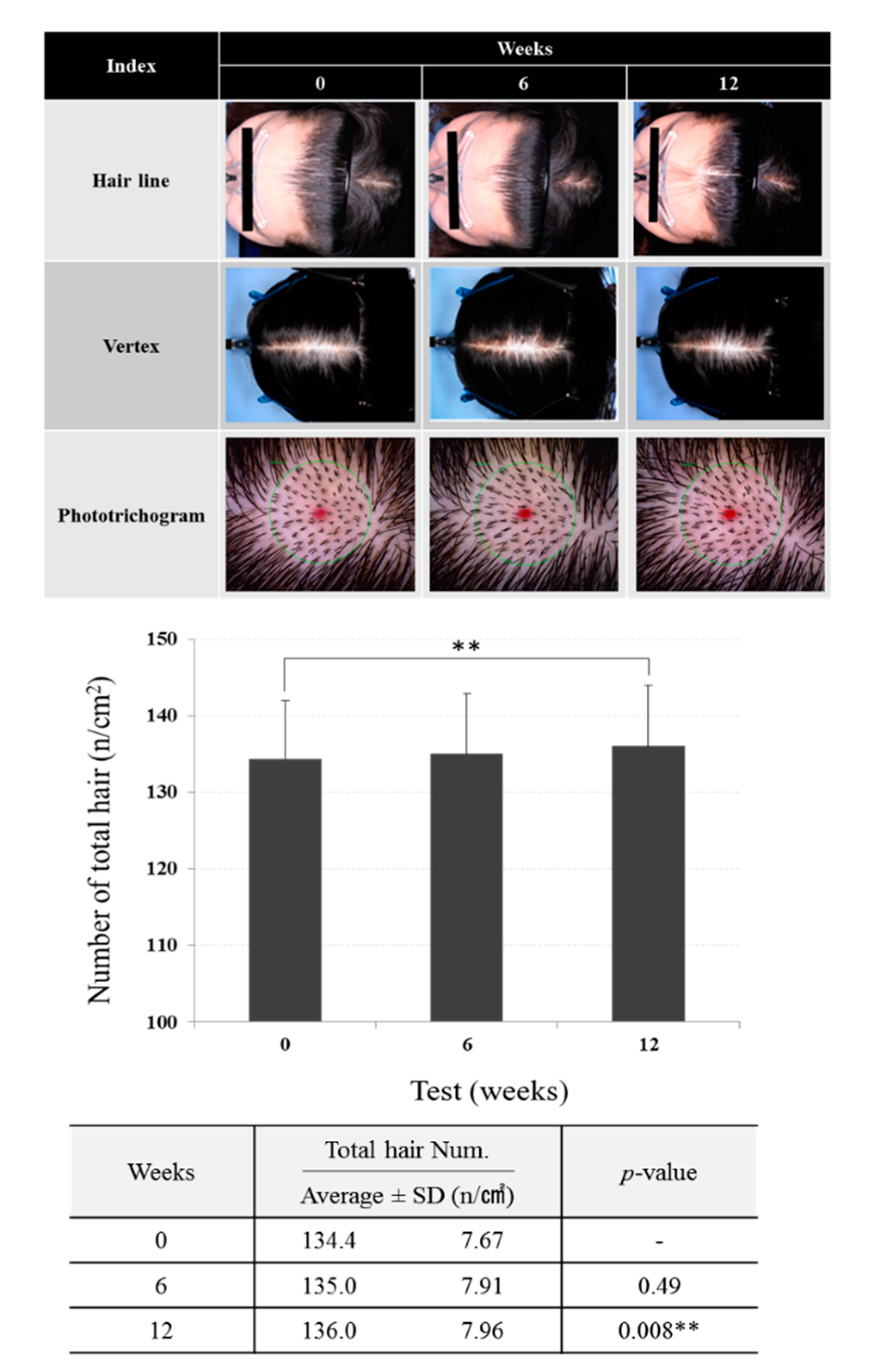 Cosmetics | Free Full-Text | Broussonetia papyrifera Promotes Hair Growth  Through the Regulation of β-Catenin and STAT6 Target Proteins: A  Phototrichogram Analysis of Clinical Samples