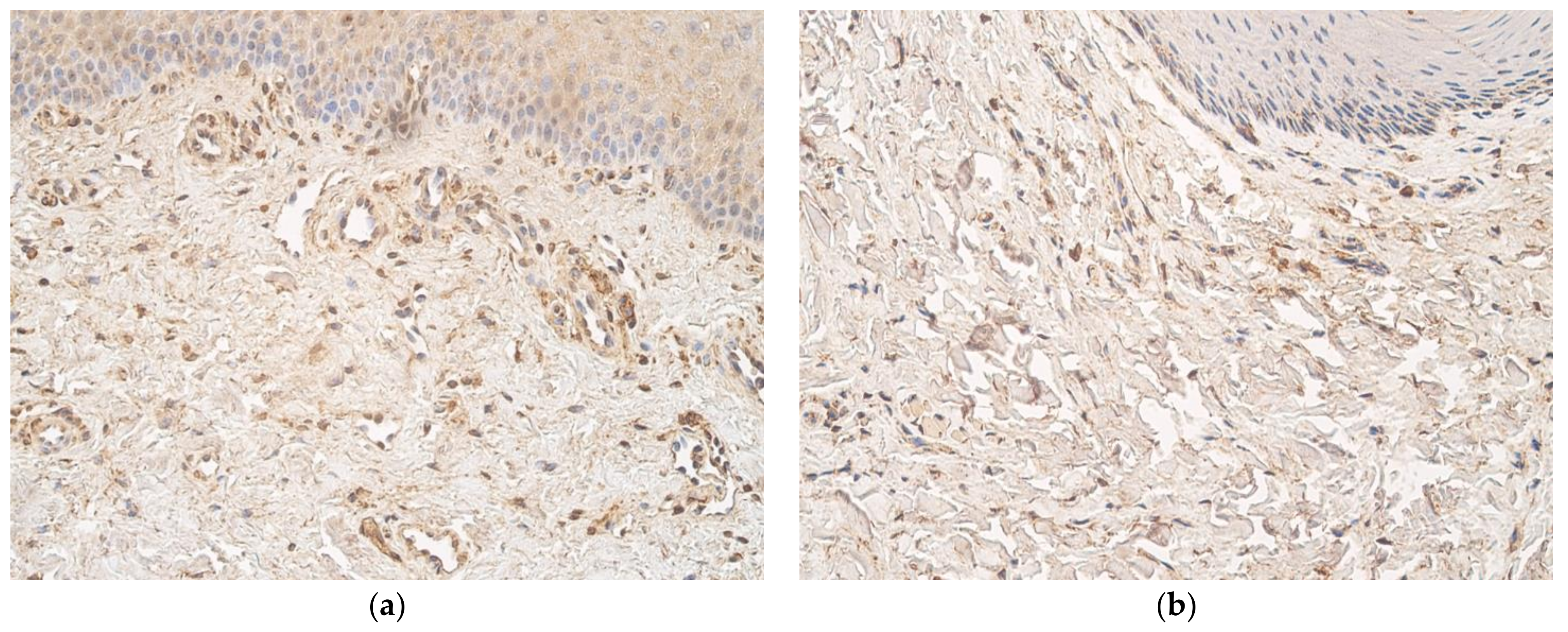 Cosmetics Free Full Text Characterization Of Macrophages And Tnf A In Cleft Affected Lip Tissue Html