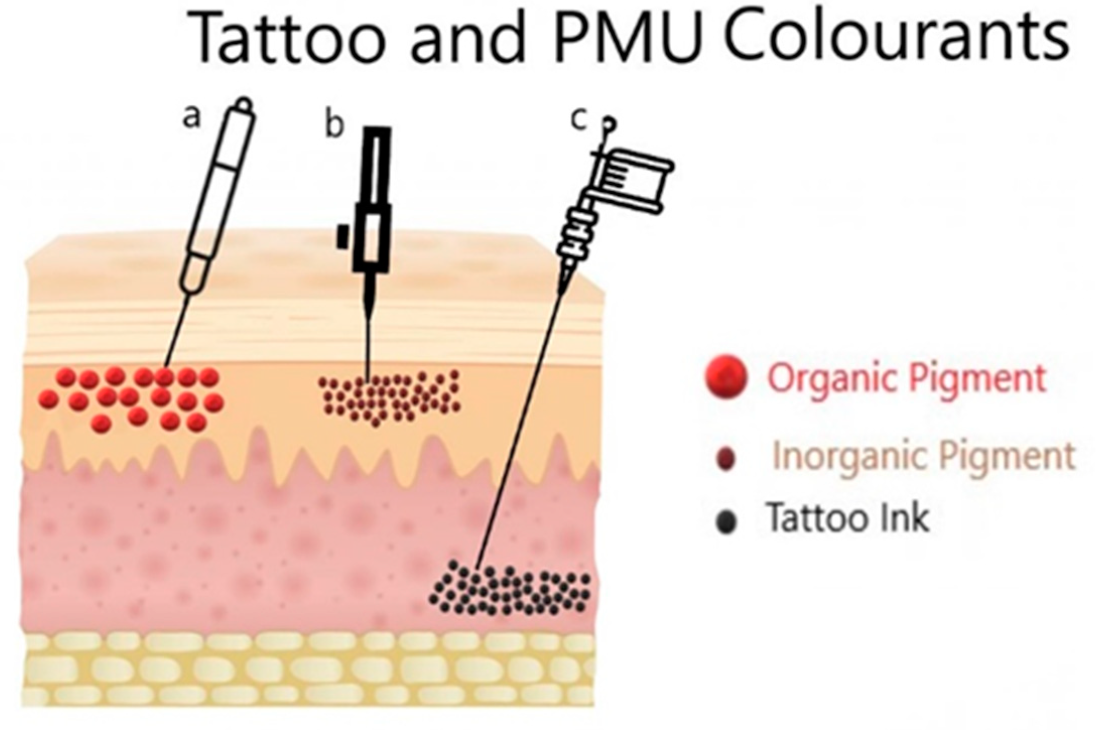 Toxic' tattoo ink particles can travel to your lymph nodes: study -  National