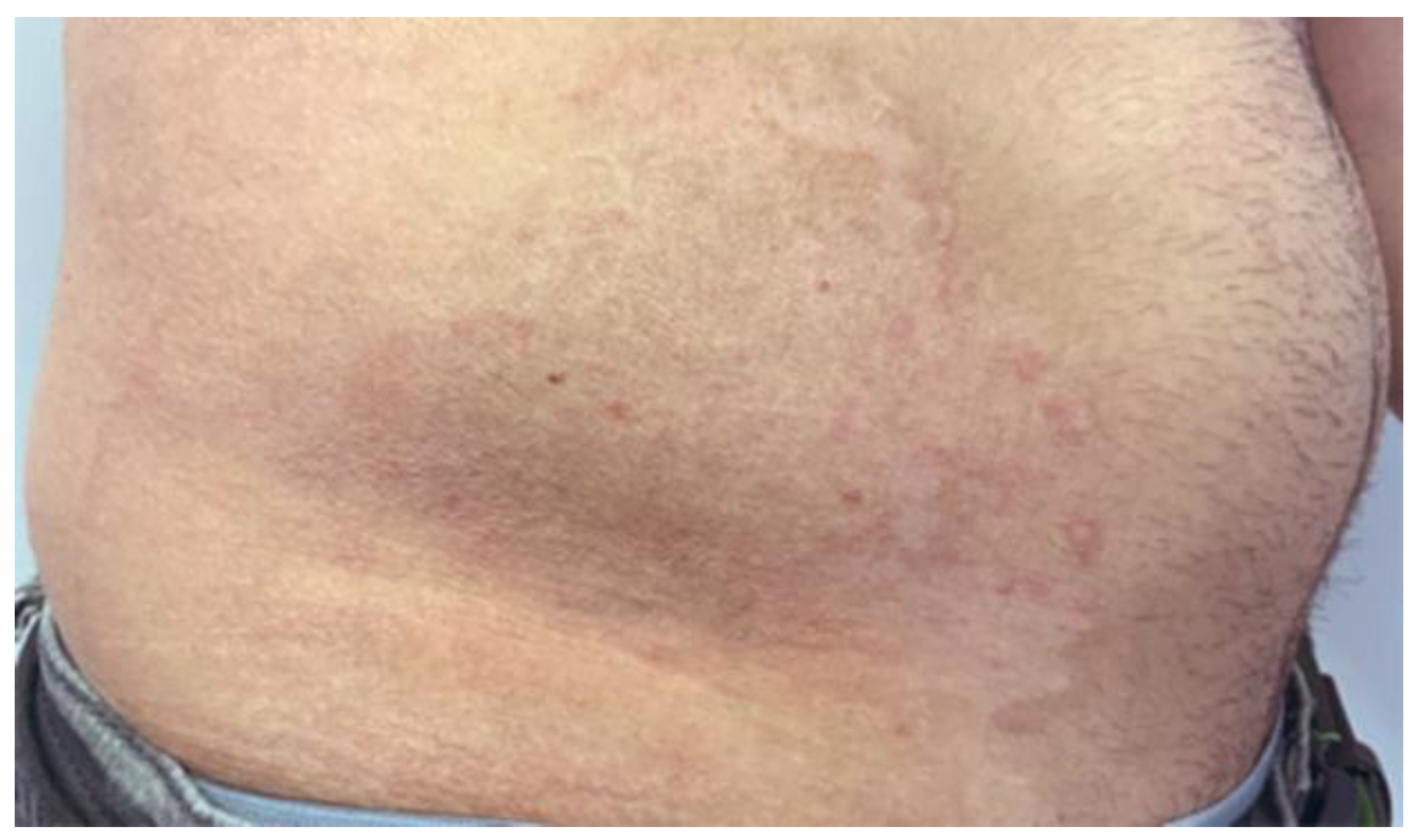 Cosmetics 09 00010 g003 550