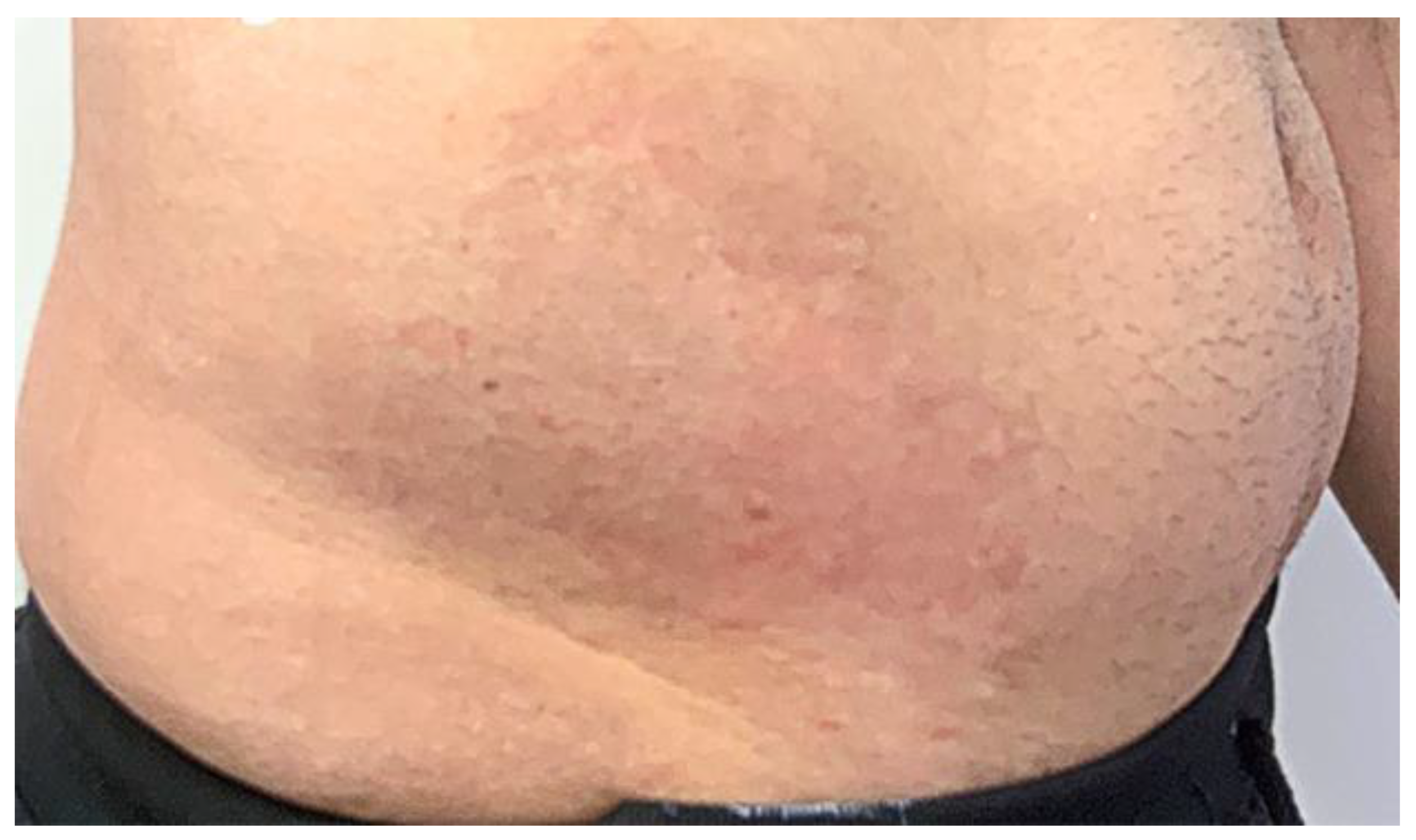 Cosmetics 09 00010 g004 550