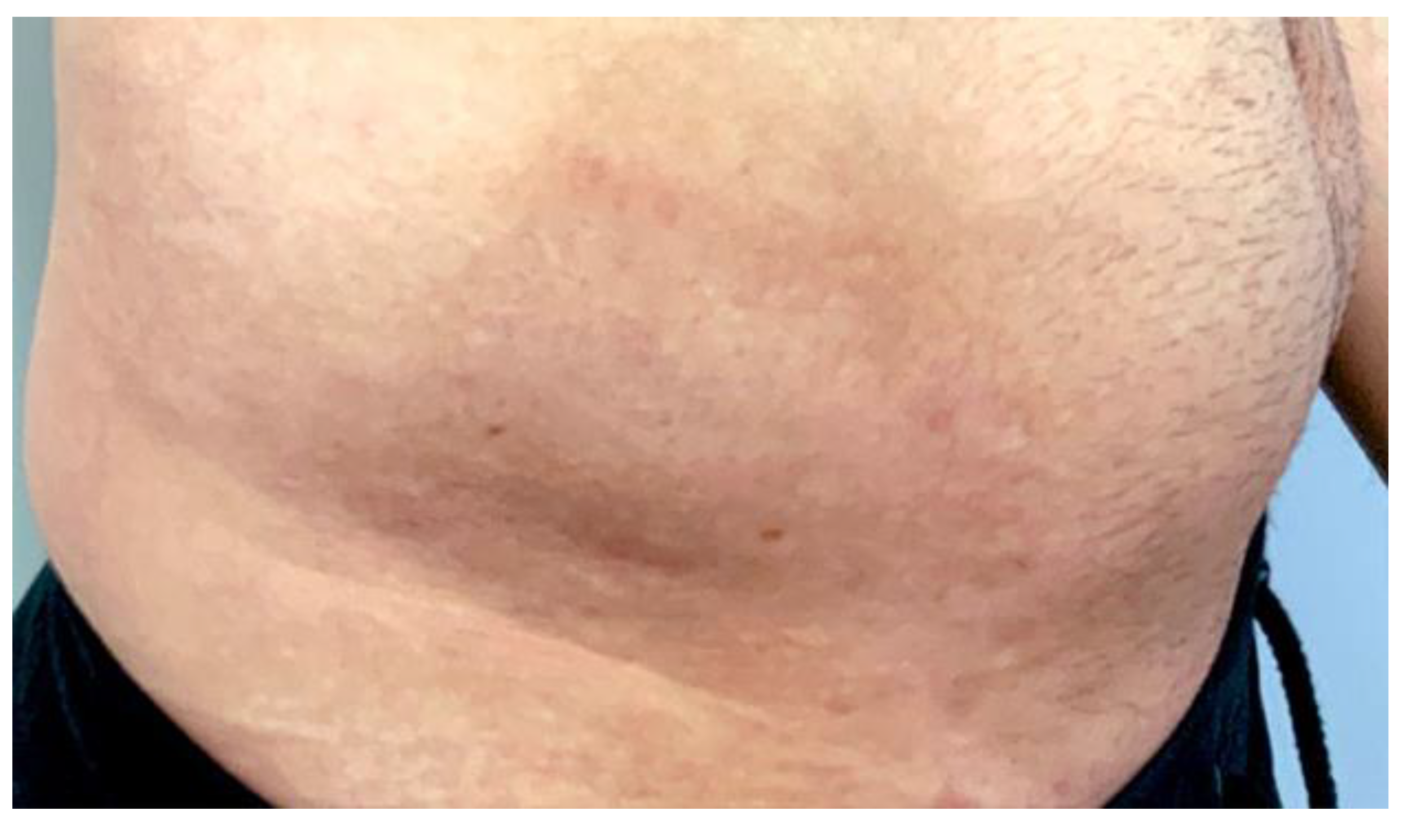 Cosmetics 09 00010 g005 550